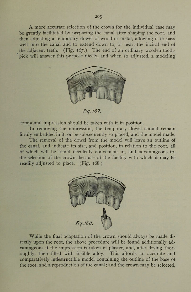 A more accurate selection of the crown for the individual case may be greatly facilitated by preparing the canal after shaping the root, and then adjusting a temporary dowel of wood or metal, allowing it to pass well into the canal and to extend down to, or near, the incisal end of the adjacent teeth. (Fig. 167.) The end of an ordinary wooden tooth- pick will answer this purpose nicely, and when so adjusted, a modeling Ficj. 167. compound impression should be taken with it in position. In removing the impression, the temporary dowel should remain firmly embedded in it, or be subsequently so placed, and the model made. The removal of the dowel from the model will leave an outline of the canal, and indicate its size, and position, in relation to the root, all of which will be found decidedly convenient in, and advantageous to, the selection of the crown, because of the facility with which it may be readily adjusted to place. (Fig. 168.) While the final adaptation of the crown should always be made di- rectly upon the root, the above procedure will be found additionally ad- vantageous if the impression is taken in plaster, and, after drying thor- oughly, then filled with fusible alloy. This affords an accurate and comparatively indestructible model containing the outline of the base of the root, and a reproduction of the canal; and the crown may be selected,