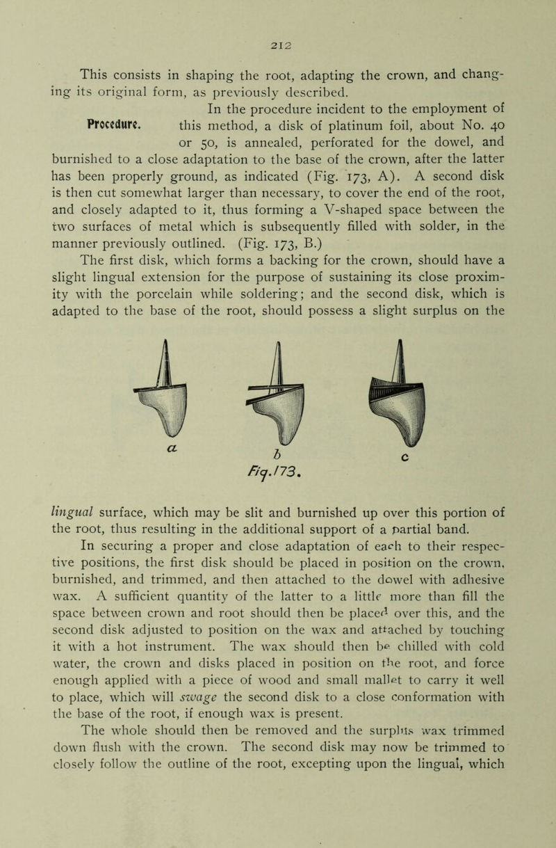 This consists in shaping the root, adapting the crown, and chang- ing its original form, as previously described. In the procedure incident to the employment of Procedure. this method, a disk of platinum foil, about No. 40 or 50, is annealed, perforated for the dowel, and burnished to a close adaptation to the base of the crown, after the latter has been properly ground, as indicated (Fig. 173, A). A second disk is then cut somewhat larger than necessary, to cover the end of the root, and closely adapted to it, thus forming a V-shaped space between the two surfaces of metal which is subsequently filled with solder, in the manner previously outlined. (Fig. 173, B.) The first disk, which forms a backing for the crown, should have a slight lingual extension for the purpose of sustaining its close proxim- ity with the porcelain while soldering; and the second disk, which is adapted to the base of the root, should possess a slight surplus on the ficj.173. lingual surface, which may be slit and burnished up over this portion of the root, thus resulting in the additional support of a partial band. In securing a proper and close adaptation of each to their respec- tive positions, the first disk should be placed in position on the crown, burnished, and trimmed, and then attached to the dowel with adhesive wax. A sufficient quantity of the latter to a little more than fill the space between crown and root should then be placed over this, and the second disk adjusted to position on the wax and attached by touching it with a hot instrument. The wax should then b& chilled with cold water, the crown and disks placed in position on the root, and force enough applied with a piece of wood and small mallet to carry it well to place, which will swage the second disk to a close conformation with the base of the root, if enough wax is present. The whole should then be removed and the surplus wax trimmed down flush with the crown. The second disk may now be trimmed to closely follow the outline of the root, excepting upon the lingual, which