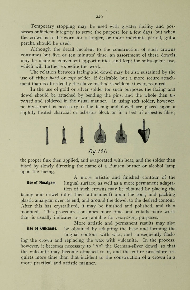 Temporary stopping may be used with greater facility and pos- sesses sufficient integrity to serve the purpose for a few days, but when the crown is to be worn for a longer, or more indefinite period, gutta percha should be used. Although the detail incident to the construction of such crowns consumes but five or ten minutes’ time, an assortment of these dowels may be made at convenient opportunities, and kept for subsequent use, which will further expedite the work. The relation between facing and dowel may be also sustained by the use of either hard or soft solder, if desirable, but a more secure attach- ment than is afforded by the above method is seldom, if ever, required. In the use of gold or silver solder for such purposes the facing and dowel should be attached by bending the pins, and the whole then in- vested and soldered in the usual manner. In using soft solder, however, no investment is necessary if the facing and dowel are placed upon a slightly heated charcoal or asbestos block or in a bed of asbestos fibre; FiqJ8l• the proper flux then applied, and evaporated with heat, and the solder then fused by slowly directing the flame of a Bunsen burner or alcohol lamp upon the facing. A more artistic and finished contour of the Use Of Hmalgam. lingual surface, as well as a more permanent adapta- tion of such crowns may be obtained by placing the facing and dowel (after their attachment) upon the root, and packing plastic amalgam over its end, and around the dowel, to the desired contour. After this has crystallized, it may be finished and polished, and then mounted. This procedure consumes more time, and entails more work than is usually indicated or warrantable for temporary purposes. More artistic and permanent results may also Use Of Uulcanite. be obtained by adapting the base and forming the lingual contour with wax, and subsequently flash- ing the crown and replacing the wax with vulcanite. In the process, however, it becomes necessary to “tin” the German-silver dowel, so that the vulcanite may become attached to it, and the entire procedure re- quires more time than that incident to the construction of a crown in a more practical and artistic manner.