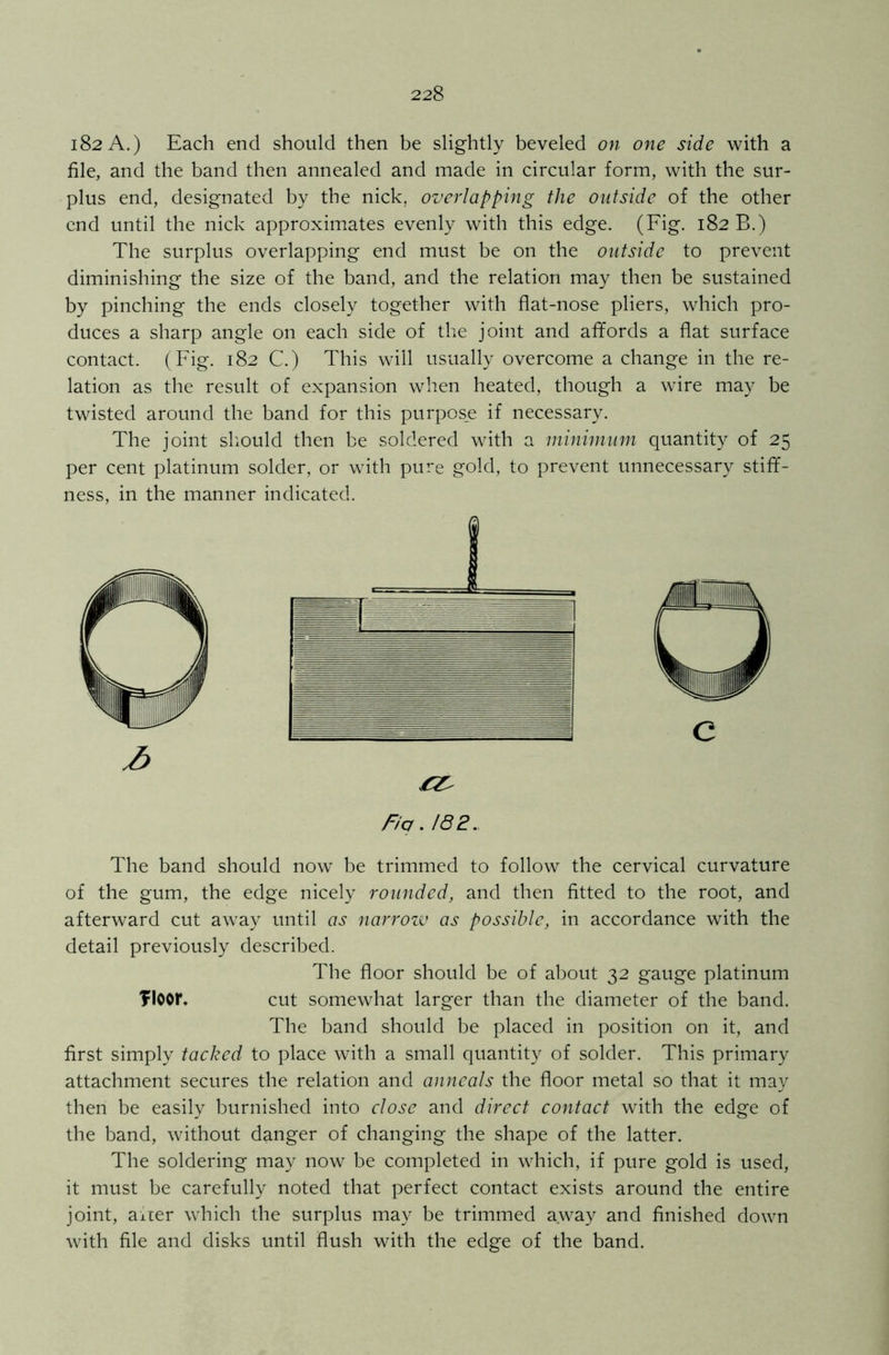 182A.) Each end should then be slightly beveled on one side with a file, and the band then annealed and made in circular form, with the sur- plus end, designated by the nick, overlapping the outside of the other end until the nick approximates evenly with this edge. (Fig. 182 B.) The surplus overlapping end must be on the outside to prevent diminishing the size of the band, and the relation may then be sustained by pinching the ends closely together with flat-nose pliers, which pro- duces a sharp angle on each side of the joint and affords a flat surface contact. (Fig. 182 C.) This will usually overcome a change in the re- lation as the result of expansion when heated, though a wire may be twisted around the band for this purpos_e if necessary. The joint should then be soldered with a minimum quantity of 25 per cent platinum solder, or with pure gold, to prevent unnecessary stiff- ness, in the manner indicated. The band should now be trimmed to follow the cervical curvature of the gum, the edge nicely rounded, and then fitted to the root, and afterward cut away until as narrow as possible, in accordance with the detail previously described. The floor should be of about 32 gauge platinum floor. cut somewhat larger than the diameter of the band. The band should be placed in position on it, and first simply tacked to place with a small quantity of solder. This primary attachment secures the relation and anneals the floor metal so that it may then be easily burnished into close and direct contact with the edge of the band, without danger of changing the shape of the latter. The soldering may now be completed in which, if pure gold is used, it must be carefully noted that perfect contact exists around the entire joint, alter which the surplus may be trimmed away and finished down with file and disks until flush with the edge of the band.