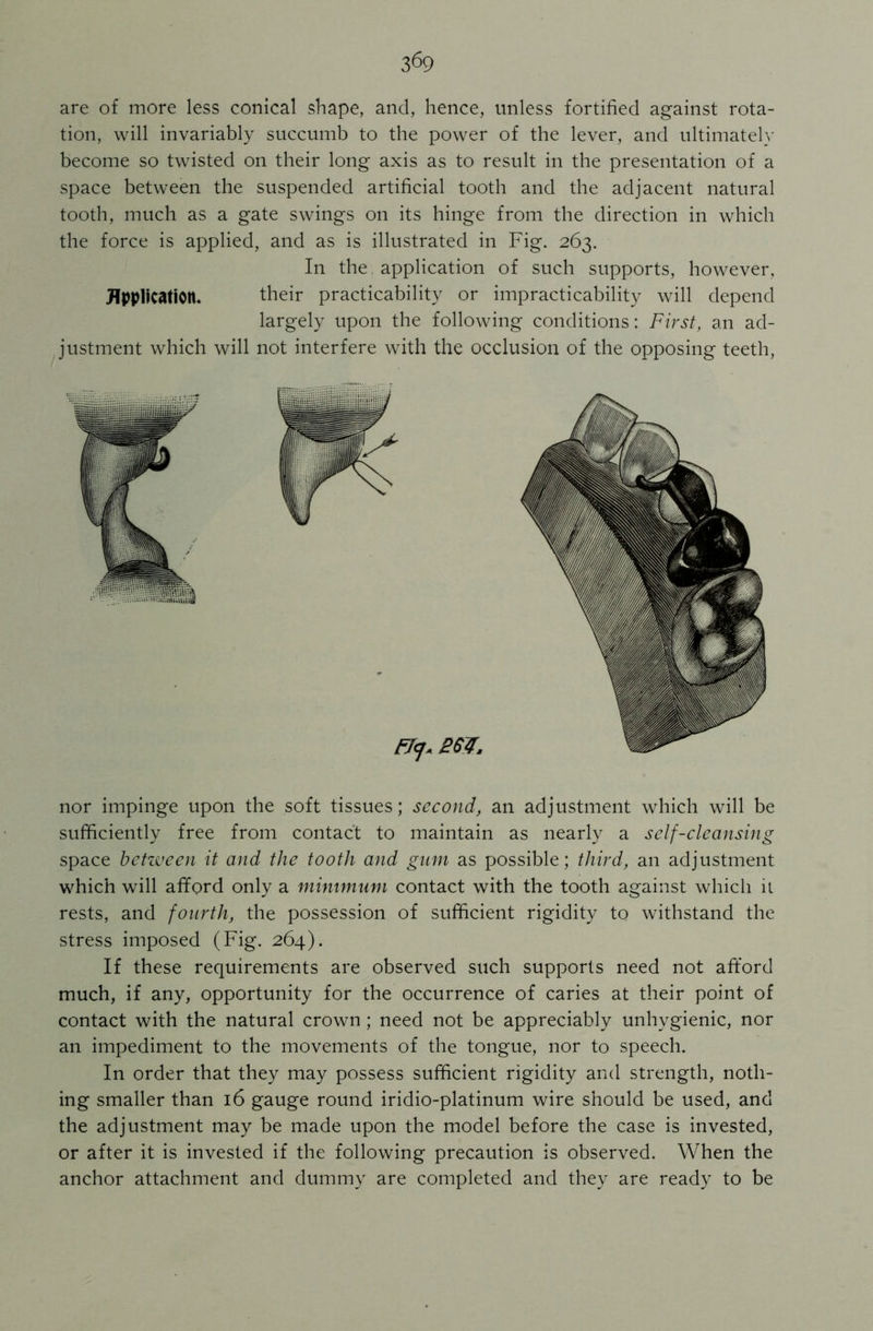 are of more less conical shape, and, hence, unless fortified against rota- tion, will invariably succumb to the power of the lever, and ultimately become so twisted on their long axis as to result in the presentation of a space between the suspended artificial tooth and the adjacent natural tooth, much as a gate swings on its hinge from the direction in which the force is applied, and as is illustrated in Fig. 263. In the. application of such supports, however, Application. their practicability or impracticability will depend largely upon the following conditions: First, an ad- justment which will not interfere with the occlusion of the opposing teeth, nor impinge upon the soft tissues; second, an adjustment which will be sufficiently free from contact to maintain as nearly a self-cleansing space between it and the tooth and gam as possible; third, an adjustment which will afford only a minimum contact with the tooth against which it rests, and fourth, the possession of sufficient rigidity to withstand the stress imposed (Fig. 264). If these requirements are observed such supports need not afford much, if any, opportunity for the occurrence of caries at their point of contact with the natural crown; need not be appreciably unhygienic, nor an impediment to the movements of the tongue, nor to speech. In order that they may possess sufficient rigidity and strength, noth- ing smaller than 16 gauge round iridio-platinum wire should be used, and the adjustment may be made upon the model before the case is invested, or after it is invested if the following precaution is observed. When the anchor attachment and dummy are completed and they are ready to be