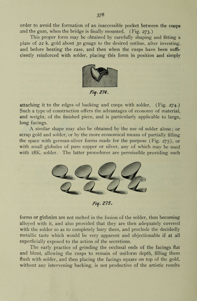 order to avoid the formation of an inaccessible pocket between the cusps and the gum, when the bridge is finally mounted. (Fig. 273.) This proper form may be obtained by carefully shaping and fitting a plate of 22 k. gold about 30 guage to the desired outline, after investing, and before heating the case, and then when the cusps have been suffi- ciently reinforced with solder, placing this form in position and simply Ficj. 274. attaching it to the edges of backing and cusps with solder. (Fig. 274.) Such a type of construction offers the advantages of economy of material, and weight, of the finished piece, and is particularly applicable to large, long facings. A similar shape may also be obtained by the use of solder alone; or scrap gold and solder, or by the more economical means of partially filling the space with german-silver forms made for the purpose (Fig. 275), or with small globules of pure copper or silver, any of which may be used with 18K. solder. The latter procedures are permissible providing such Fiq. 275. forms or globules are not melted in the fusion of the solder, thus becoming alloyed with it, and also provided that they are then adequately covered with the solder so as to completely bury them, and preclude the decidedly metallic taste which would be very apparent and objectionable if at all superficially exposed to the action of the secretions. The early practice of grinding the occlusal ends of the facings flat and blunt, allowing the cusps to remain of uniform depth, filling them flush with solder, and then placing the facings square on top of the gold, without any intervening backing, is not productive of the artistic results