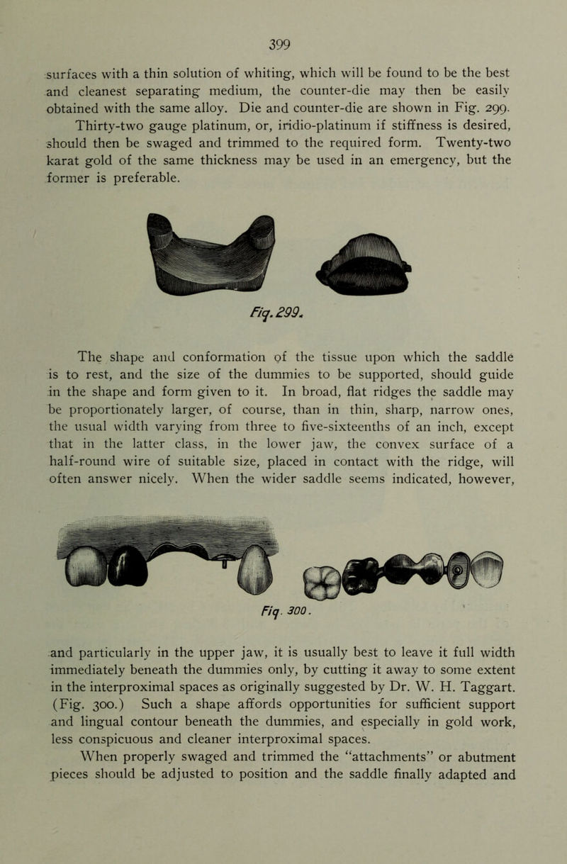 surfaces with a thin solution of whiting, which will be found to be the best and cleanest separating medium, the counter-die may then be easily obtained with the same alloy. Die and counter-die are shown in Fig. 299. Thirty-two gauge platinum, or, iridio-platinum if stiffness is desired, should then be swaged and trimmed to the required form. Twenty-two karat gold of the same thickness may be used in an emergency, but the former is preferable. Fiq.299* The shape and conformation pf the tissue upon which the saddle is to rest, and the size of the dummies to be supported, should guide in the shape and form given to it. In broad, flat ridges the saddle may be proportionately larger, of course, than in thin, sharp, narrow ones, the usual width varying from three to five-sixteenths of an inch, except that in the latter class, in the lower jaw, the convex surface of a half-round wire of suitable size, placed in contact with the ridge, will often answer nicely. When the wider saddle seems indicated, however, Fiq 300. and particularly in the upper jaw, it is usually best to leave it full width immediately beneath the dummies only, by cutting it away to some extent in the interproximal spaces as originally suggested by Dr. W. H. Taggart. (Fig. 300.) Such a shape affords opportunities for sufficient support and lingual contour beneath the dummies, and especially in gold work, less conspicuous and cleaner interproximal spaces. When properly swaged and trimmed the “attachments” or abutment pieces should be adjusted to position and the saddle finally adapted and