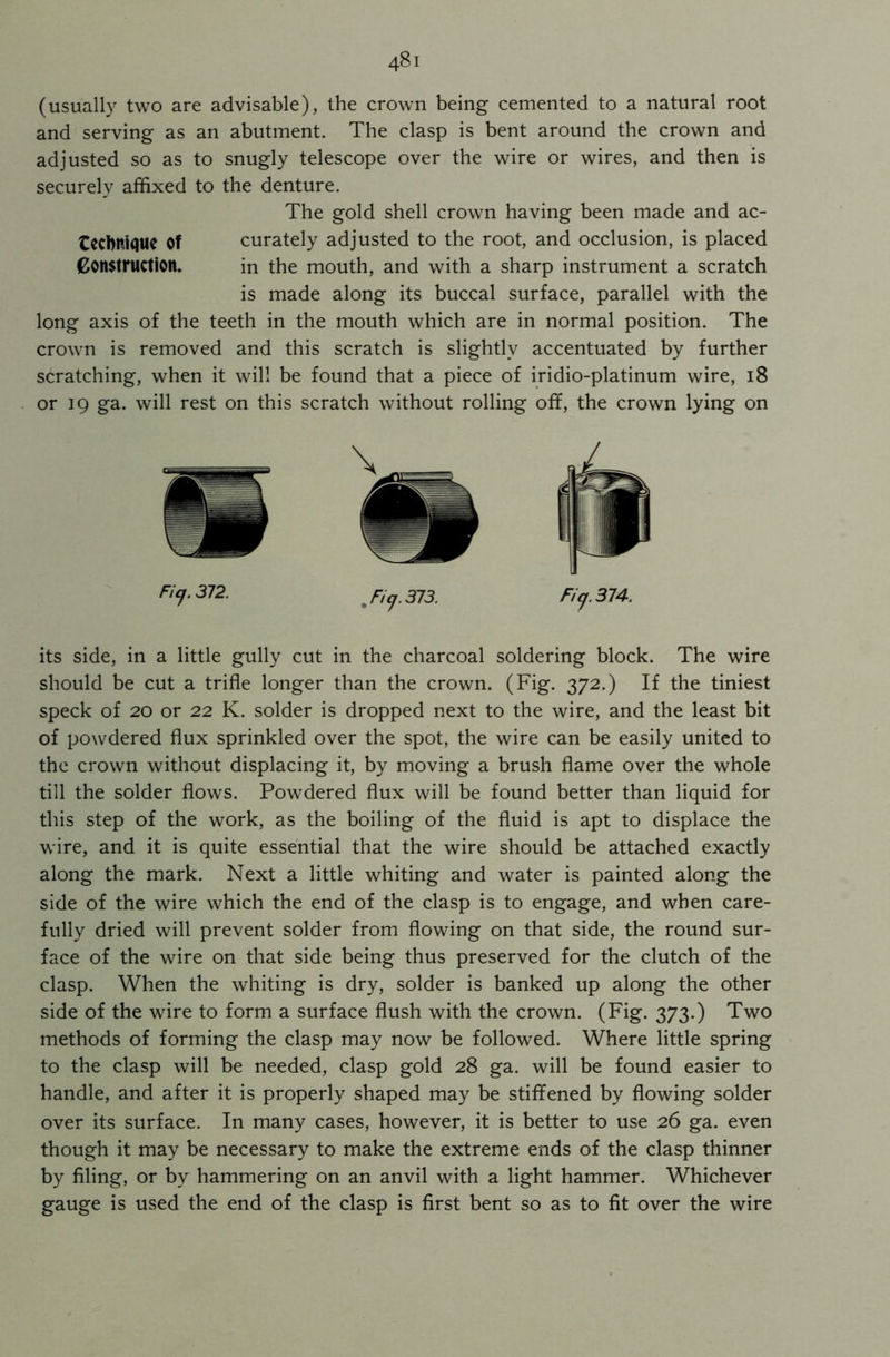 (usually two are advisable), the crown being cemented to a natural root and serving as an abutment. The clasp is bent around the crown and adjusted so as to snugly telescope over the wire or wires, and then is securely affixed to the denture. The gold shell crown having been made and ac- tecbnique of curately adjusted to the root, and occlusion, is placed Construction. in the mouth, and with a sharp instrument a scratch is made along its buccal surface, parallel with the long axis of the teeth in the mouth which are in normal position. The crown is removed and this scratch is slightly accentuated by further scratching, when it will be found that a piece of iridio-platinum wire, 18 or 19 ga. will rest on this scratch without rolling off, the crown lying on Ficf-372- , Ficj. 373. Fi(j. 374. its side, in a little gully cut in the charcoal soldering block. The wire should be cut a trifle longer than the crown. (Fig. 372.) If the tiniest speck of 20 or 22 K. solder is dropped next to the wire, and the least bit of powdered flux sprinkled over the spot, the wire can be easily united to the crown without displacing it, by moving a brush flame over the whole till the solder flows. Powdered flux will be found better than liquid for this step of the work, as the boiling of the fluid is apt to displace the wire, and it is quite essential that the wire should be attached exactly along the mark. Next a little whiting and water is painted along the side of the wire which the end of the clasp is to engage, and when care- fully dried will prevent solder from flowing on that side, the round sur- face of the wire on that side being thus preserved for the clutch of the clasp. When the whiting is dry, solder is banked up along the other side of the wire to form a surface flush with the crown. (Fig. 373.) Two methods of forming the clasp may now be followed. Where little spring to the clasp will be needed, clasp gold 28 ga. will be found easier to handle, and after it is properly shaped may be stiffened by flowing solder over its surface. In many cases, however, it is better to use 26 ga. even though it may be necessary to make the extreme ends of the clasp thinner by filing, or by hammering on an anvil with a light hammer. Whichever gauge is used the end of the clasp is first bent so as to fit over the wire