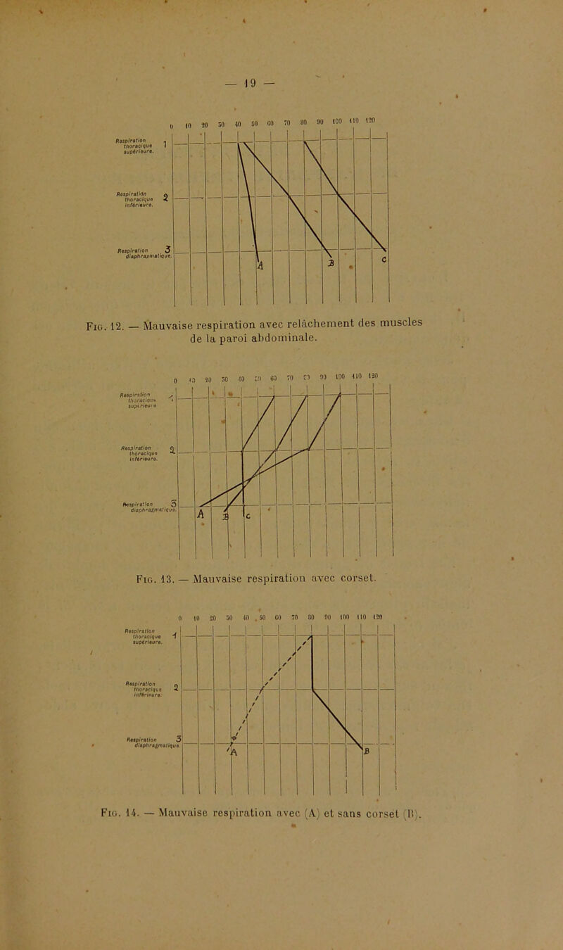 Fig. 12. — Mauvaise respiration avec relâchement des muscles de la paroi abdominale. Fig. 13. — Mauvaise respiration avec corset. f 0 10 50 50 10 , 50 00 70 00 00 ( 00 110 150 Respiration . 1 1 supérieure. / Respiration „ ilioraciquo •< inférieure. Respiration J » diaphragmatique — — ■ ✓ / / é / / / / / 1 / / f t / k \ \ b — - / h \ Fig. 14. — Mauvaise respiration avec (A.) et sans corset (li).