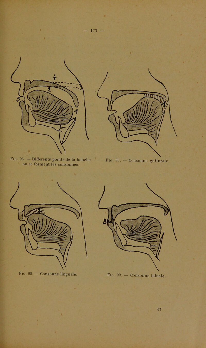 96. — Différents points de la bouche où se forment les consonnes. Fig. 97. — Consonne gutturale y ../TV^*r ir''1 lli,r^SA i 3| *5r. \ A Xt-'* i*TlJ J \ \ •• If \ \ \ \ \ \ \ ) ^«T-*- // Fig. 98. — Consonne linguale. Fig. 99. — Consonne labiale. 12