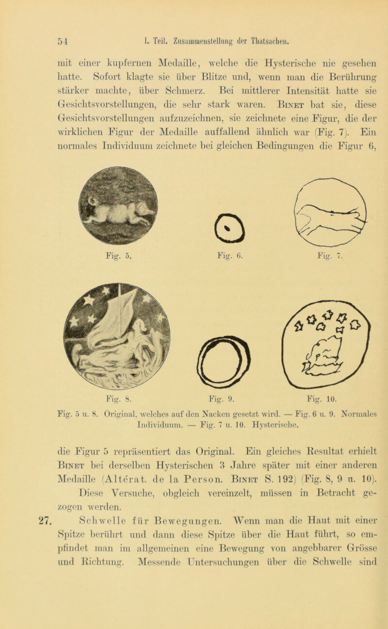 mit einer kupfernen Medaille, welche die Hysterische nie gesehen hatte. Sofort klagte sie über Blitze und, wenn man die Berührung stärker machte, über Schmerz. Bei mittlerer Intensität hatte sie (TesichtsYorstellungen, die sehr stark waren. Bixet hat sie, diese Gesichtsvorstellungen aufzuzeichnen, sie zeichnete eine Figur, die der wirklichen Figur der Medaille auffallend ähnlich war ^Fig. 7). Ein normales Individuum zeichnete hei gleichen Bedingungen die Figur 6, Fig. 5 u. 8. Original, welches auf den Nacken gesetzt wird. — Fig. 6 n. 9. Normales Individuum. — Fig. 7 u. 10. Hysterische. die Figur 5 re})räsentiert das Original. Ein gleiches Resultat erhielt Einet hei derselben Hysterischen 3 Jahre später mit einer anderen Medaille '^Alterat. de la Person. Binet S. 192) (Fig. 8, 9 u. 10). Diese Versuche, oligleich vereinzelt, müssen in Betracht ge- zogen werden. Schwelle für Bewegungen. Wenn man die Haut mit einer Spitze heridirt und dann diese Spitze über die Haut führt, so em- j)tindet man im allgemeinen eine Bewegung von angehbarer Grösse und Richtung. Messende Untersuchungen über die Schwelle sind