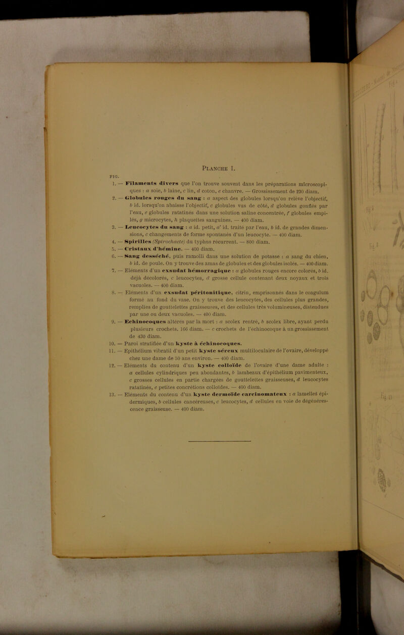 Planche I. Filaiiieiit»^ rtivoi’s que l’on trouve souvent dans les préparations mlcroscopi- ques : a soie, h laine, c Un, d coton, e chanvre. — Grossissement de 230 diam. Crlobiiles roiigos du sang : a aspect des globules lorsqu’on relève l’objectif, ì) id. lorsqu’on abaisse l’objectif, c globules vus de còté, d globules gonflés par l’eau, e globules ratatinés dans une solution saline concentrée, f globules empi- lés, g microcytes, 7i plaquettes sanguines. — 400 diam. Iieiicocytes du saug : a id. petit, a' id. traité par l’eau, b id. de grandes dimen- sions, c changements de forme spontanés d’un leucocyte. — 400 diam. Spirine» (SpirocJiaete) du typhus récurrent. — 800 diam. Cristaux d’iténiine. — 400 diam. Saiig desséclié, puis ramolli dans une solution de potasse : a sang du chien, b id. de poule. On y trouve des amas de globules et des globules isolés. — 400 diam. Eléments d'un exsudat liémorragiciiie : a globules rouges encore colorés, b id. déjà décolorés, c leucocytes, d grosse cellule contenant deux noyaux et trois vacuoles. — 400 diam. Eléments d’un exniidat péritonitique, citrin, emprisonnés dans le coagulum formé au fond du vase. On y trouve des leucocytes, des cellules plus grandes, remplies de goultelettes graisseu.ses, et des cellules très volumineuses, distendues par une ou deux vacuoles. — 400 diam. Ecliiiiocoques altérés par la mori ; a scolex rentré, b scolex libre, ayant perdu plusieurs crochets, IGG diam. — c erodiets de l’échinocoque à un grossissement de 430 diam. Paroi stratiflée d’un kyste ii écliinoe.oques. Epithélium vibratil d’un petit kyste séreux multiloculaire de l’ovaire, développé chez une dame de 50 ans euviron. — 400 diam. Eléments du contenu d’un kyste colloide de l’ovaire d’une dame adulte ; a cellules cylindriques peu abondantes, b lambeaux d’épithélium pavimenteux, c grosses cellules en partie chargées de goutteleltes graisseuses, d leucocytes ratatinés, e petites concrétions coilotdes. — 400 diam. Eléments du contenu d’un kyste dermoide carcinomateiix : a lamelleé épi- dermiques, b cellules cancéreuses, c leucocytes, d cellules en voie de dégénéres- cence graisseuse. — 400 diam.