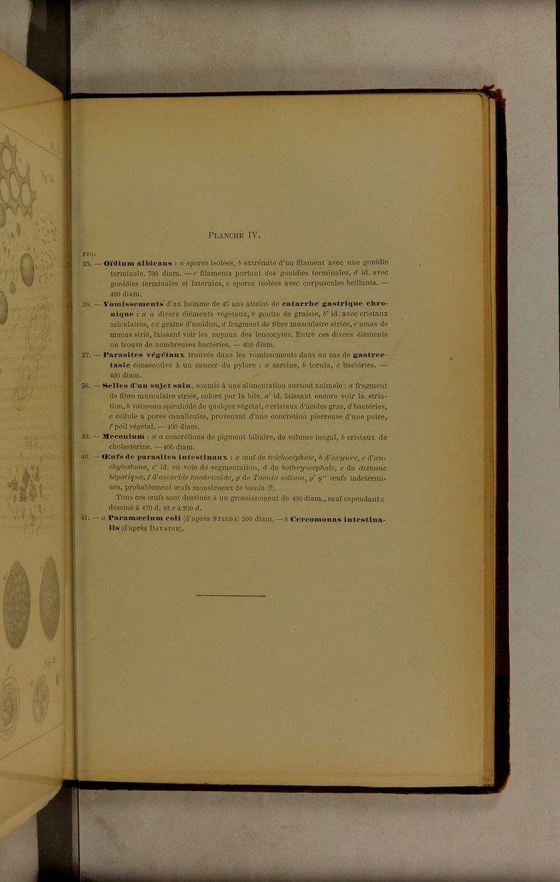 FIG. 35. — Oirtiuin albicane : a spores isolées, b extrémité d’un filament avec ime gonidie terminale. 700 diam. — c. fliaments portant des gonidies terminales, cl id. avec gonidies terminales et latérales, e spores isolées avec corpuscules brillants. — 400 diam. 36. — Voinissenients d’un homme de 45 ans atleint de catarrhe gastriqne chi’o- nìqiie : a a divers éléments végétau-v, b goutte de graisse, V id. avec cristaux aciculaires, cc grains d’amidon, d fragmenl de fibre musculaire stride, e amas de mucus striò, laissant voir les noyaux des leucocytes. Entre ces divers éléments on trouve de nombreuses bactéries. — 400 diam. 37. — Parasites végétaiix trouvés dans les vomissements dans un cas de gastrec- tasie consecutive à un cancer du pylore : a sarcine, b torula, c bactéries. — 400 diam. 38. — Selles d’uii snjet saiii, soumis à ime alimenlation surtout animale : a fragment de fibre musculaire stride, colore par la bile, a' id. laissant encore voir la stria- tion, b vaisseau spiralo'lde de quelque végétal, c cristaux d’acides gras, d bactéries, c cellule à pores canaliculés, provenant d’une concrétion pierreuse d’une poire, /'poil végétal. —400 diam. 30. — Meconliiiu : a a concrétions de pigment biliaire, de volume inégal, b cristaux de cholestérine. —400 diam. 40. — <Kufs de parasites liitestinaux : a oeuf de tricliocéphcde, b d.'oxyure, c A'an- chylostome, c' id. en voie de segmentation, d de botliryocèphale, e de distarne hépatiqiie, f òi:ascaride lombrico'ide, g de Taenia soUum, g' g” ceufs indétermi- nés, probablement CBufs monstrueux de tcenia (?). Tous ces oeufs sont dessinés à un grossissement de 400 diam., sauf cependantc dessiné à 470 d. et e à 200 d. 41. — a Paramoeciiiiii eoli (d’après Stieda) 300 diam. —6 Cercoiiiunas iiitestina- lis (d’aprés Davaine).