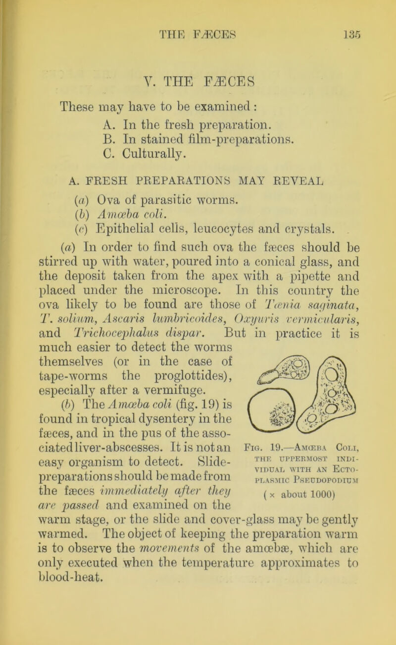 Y. THE F^CES These may have to be examined: A. In the fresh preparation. B. In stained film-preparations. C. Culturally. A. FEESH PREPAEATIONS MAY REVEAL {a) Ova of parasitic worms. {b) Ämceha coli. {(•) Epithelial celis, leucocytes and crystals. (a) In Order to find such ova the ffeces should be stirred up with water, poured into a conical glass, and the deposit taken from the apex with a pipette and placed under the microscope. In this conntry the ova likely to be found are those of Tcenia aaginata, T. solinm., A.'icaris lumbricoides, Oxyuris vermii ularis, and Ti'ichocephaluH dispar. But in practice it is inuch easier to detect the worms themselves (or in the case of tape-worms the proglottides), especially after a vermifuge. (b) The Ämoeba coli (fig. 19) is found in tropical dysentery in the faeces, and in the pus of the asso- ciated liver-abscesses. It is not an easy organism to detect. Slide- preparations should be made froin the ffeces immediately after tliey are passed and examined on the warm stage, or the slide and cover-glass may be gently warmed. The object of keeping the preparation warm is to observe the movements of the amoebae, which are only executed when the temperature approximates to blood-heat. Fig. 19.—Amcp.ba Coli, THK DPrERMOHT INDI- VIDUAL WITH AN EcTO- PLASMIC PSEDDOPODIUM ( X about 1000)
