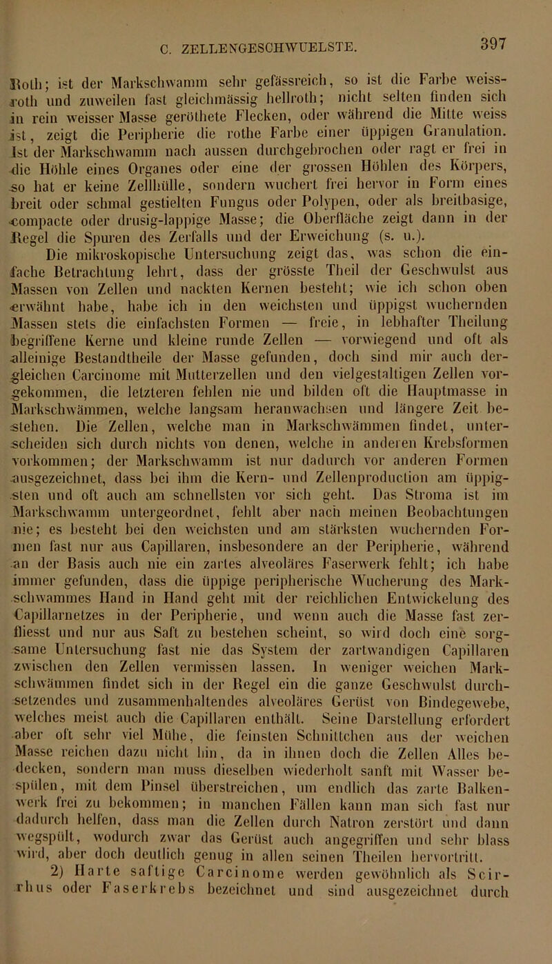 Holh; ist der Markschwamm sehr gefässreich, so ist die Farbe weiss- a’oth und zuweilen fast gleichmässig hellroth; nicht selten finden sich in rein w7eisser Masse gerölhete flecken, oder während die Mitte weiss ist, zeigt die Peripherie die rothe Farbe einer üppigen Granulation. Ist der Markschwamm nach aussen durchgehrochen oder ragt er frei in die Hohle eines Organes oder eine der grossen Höhlen des Körpers, .so hat er keine Zellhülle, sondern wuchert frei hervor in Form eines breit oder schmal gestielten Fungus oder Polypen, oder als breitbasige, ■compacte oder drüsig-lappige Masse; die Oberfläche zeigt dann in der Hegel die Spuren des Zerfalls und der Erweichung (s. u.). Die mikroskopische Untersuchung zeigt das, was schon die ein- fache Betrachtung lehrt, dass der grösste Theil der Geschwulst aus Massen von Zellen und nackten Kernen besteht; wie ich schon oben erwähnt habe, habe ich in den weichsten und üppigst wuchernden Massen stets die einfachsten Formen — freie, in lebhafter Theilung begriffene Kerne und kleine runde Zellen — vorwiegend und oft als ■alleinige Bestandtheile der Masse gefunden, doch sind mir auch der- gleichen Carcinome mit Mutterzellen und den vielgestaltigen Zellen vor- gekommen, die letzteren fehlen nie und bilden oft die Hauptmasse in Markschwämmen, welche langsam heranwachsen und längere Zeit be- stehen. Die Zellen, welche man in Markschwämmen findet, unter- scheiden sich durch nichts von denen, welche in anderen Krebsformen Vorkommen; der Markschwamm ist nur dadurch vor anderen Formen ausgezeichnet, dass bei ihm die Kern- und Zellenproduction am üppig- sten und oft auch am schnellsten vor sich geht. Das Stroma ist im Markschwamm untergeordnet, fehlt aber nach meinen Beobachtungen nie; es besteht bei den weichsten und am stärksten wuchernden For- men fast nur aus Capillaren, insbesondere an der Peripherie, während an der Basis auch nie ein zartes alveoläres Faserwerk fehlt; ich habe immer gefunden, dass die üppige peripherische Wucherung des Mark- schwammes Hand in Hand geht mit der reichlichen Entwickelung des Capillarnetzes in der Peripherie, und wenn auch die Masse fast zer- fliesst und nur aus Saft zu bestehen scheint, so wird doch eine sorg- same Untersuchung fast nie das System der zartwandigen Capillaren zwischen den Zellen vermissen lassen. In weniger weichen Mark- schwämmen findet sich in der Kegel ein die ganze Geschwulst durch- setzendes und zusammenhaltendes alveoläres Gerüst von Bindegewebe, welches meist auch die Capillaren enthält. Seine Darstellung erfordert aber oft sehr viel Mühe, die feinsten Schnittchen aus der weichen Masse reichen dazu nicht hin, da in ihnen doch die Zellen Alles be- decken, sondern man muss dieselben wiederholt sanft mit Wasser be- spülen , mit dem Pinsel überstreichen, um endlich das zarte Balken- werk frei zu bekommen; in manchen Fällen kann man sich fast nur dadurch helfen, dass man die Zellen durch Natron zerstört und dann wegspült, wodurch zwar das Gerüst auch angegriffen und sehr blass wird, aber doch deutlich genug in allen seinen Theilen hervortritt. 2) Harte saftige Carcinome werden gewöhnlich als Scir- rhus oder Faserkrebs bezeichnet und sind ausgezeichnet durch
