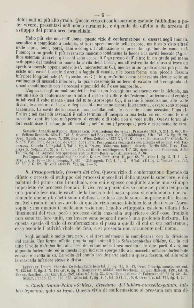 dcformati al piü alto grado. Questo vizio di conformazione esclude l’attitudine a po- ter vivere, presentasi neH’uomo raramenle, e dipende da difetto o da arresto di sviluppo del primo arco branchiale. Molto piü che non nell’ uomo questo vizio di conformazione si osserva negli animali, semplice o complicato a ciclopia, si trova specialmenle nelle pecore, ma ö stato visto altresi lielle capre, buoi, porci, cani e conigli. L’ allerazione si presenta egualmente come nel- l’uomo; in un grado il piü avvanzato mancano lolalmente la bocca e la cavita boccale (Agna- thus astomus Gürlt) e gli occhi sono accostati 1’ un presso dell* altro; in un grado poi meno sviluppato del medesimo manca la cavita della bocca, ma aU’estremilä del muso si trova un apcrtura boccale appena notevole (A, microstomus G.), mentre in un grado ancora piü piccolo esisle una cavita boccale ristretta a foggia di canale, e la bocca forma una piccola fessura inleriore longitudinale (A. hypostomus G.). In quest’ultimo caso si presenta alcune volle un rudimenlo di mascella inferiore, la quäle rassomiglia un ferro di cavallo ed e congiunta al- quanto mobilmente con i processi zigomatici dell’ osso temporale.. L’agnazia negli animali suddetti talvolta non e congiunta solamente cori la ciclopia, ma con un vizio di conformazione di tutto il resto del volto e deH’estremitä anteriore del cranio; in tali casi il volto manca quasi del tutto (Aprosopus G.), il cranio e piccolissimo, alle volle diviso, lc aperture del naso e degli occhi o mancano ancora inleramentc, ovvcro sono appena accennate. La cavita della bocca manca perfettamente, le orecchie stanno accoslate l’una al- I’ altra ; nei casi piü avvanzati il collo termina all’ insopra in una testa, su cui stanno le due orecchie avenli fra loro un’aperlura, di cranio c di volto non si vede nulla. Questa forma al- lora coslituisce il passaggio all’ acefalia, nell’ uomo (Aprosopus) perö e estremamente rara. Semplice Agnazia nell’uomo: Hesselbach, Beschreibung der Würzb. Präparate 1824. S. 2S4. N. 643. Ot- to, Seltene Beobach. 1824 II. Taf. 3, riportate nel Foerster, die Missbildungen, Atlas Taf. 13 fig. 19, 20. Otto, Monstr. sexc. descr. N. 386. Braun, Wien. Zeitschr. 1853 XI, 11. Guerdan, Monatschr. für Gebtsk. X. S. 176. Paul Bull, de la Soc. de Gand. 1857 Fevr. Per l’agnazia complicata con ciclopia ed acrania vcdi Tie- demann, Zeitschr. f. Physiol. I, Taf. 6, fig. 8. Knape, Monstrum human, descrip. Berlin 1823. Diez, Fro- rieps N. Notizen Bd. 33, N. 6. Vrolik Tab. ad illustr. embriogenes. Taf. 26, riportata dal Foerster, Atlas Taf. 13, fig. 23. Agnazia con aprosopia vedi in Otto Descr. monstr. scxccnt. N. 88. Per l’agnazia ed aprosopia negli animali: Gurlt, Path. Anat. II, pag. 68, 76. Atlas I, fig. 5, II. 1 — 3. Otto 1. c. N. 89 — 100 aprosopia. N. 187 — 210 Agenia Taf. 1, fig. 2 — 6 Taf. VIII fig. 2. Vrolik 1. c. Taf. 58, 59. J. G. St. Hilaire Atlas PI. VII, fig. 2 — 5. b. Prosoposchisis, fessura del viso. Questo vizio di conformazione dipende da difetto o arresto di sviluppo dei processi mascellari della mascella superiore, e dei palalini del primo arco branchiale, con cui e spesso congiunto ancheuno sviluppo imperfetto de* processi fronlali. 11 viso resta perciö diviso come nel primo tempo da una grande fessura, le cavila della bocca e del naso spesso si confondono, non ra- rarnente anche gli occhi sono difettosi e le loro cavila sono comprese nclla fessu- ra. Nel grado il piü avvanzato di questo vizio manca tolalmentc anche il viso (Apro- sopia) ; ma quando il medesimo vizio non e molto sviluppato, esistono allora i de- lineamenti del viso, perö i processi della mascella superiore e dell* osso frontale non sono tra loro uniti, ma invece sono separali merce una profonda incisura. Da questa specie di vizio di conformazione si passa a quella di cui or ora parleremo ; essa esclude 1’ altivita vitale del feto, e si preseula non raramenle nell’ uomo. Negli animali e molto rara perö, e si trova solamente in complicanza con la divisione del cranio. Una forma affatto propria agli animali e lo Schisloccphalus bifidus, G., in cui tutto il volto e diviso fino alla base del cranio nclla linea mediana, le due parli divergono alquanto fortemente, ed in questa larga incisura sporge allora la mascella inferiore forlemenlc curvata e rivolta in su. La volta del cranio prende parle anche a questa fessura, ed alle volle la mascella inferiore stessa e divisa. Leuckart, Unters, über das Zwischenkieferbein-taf. 9, fig. 31. S. 47. Otto, Descrip. monstr. sexcent. N. 133 taf. 5, fig. 3. N. 494 taf. 6, fig. 1. Sömmerring Abbild, und Beschreib, einiger Missgeb. 1791, taf. 8. Bruns, Handbuch der Chir. II, S. 262. Atlas taf. 6, lig. 32. Raccolte nell’atlante di Foerster taf. 25 fig. 30—34. Gurlt, Ilandb. II, p. 125, 126. Atlas taf. V, fig. 4, 5, taf. XVI, fig. 5, 6. Otto 1. c. taf. VII, fig. 1, 2. c. Chcilo-Gnato-Palato-Schisis, divisione del labbro-mascella-palato, lab- bro leporino, gola di lupo. Questo vizio di conformazione si presenta con una di-
