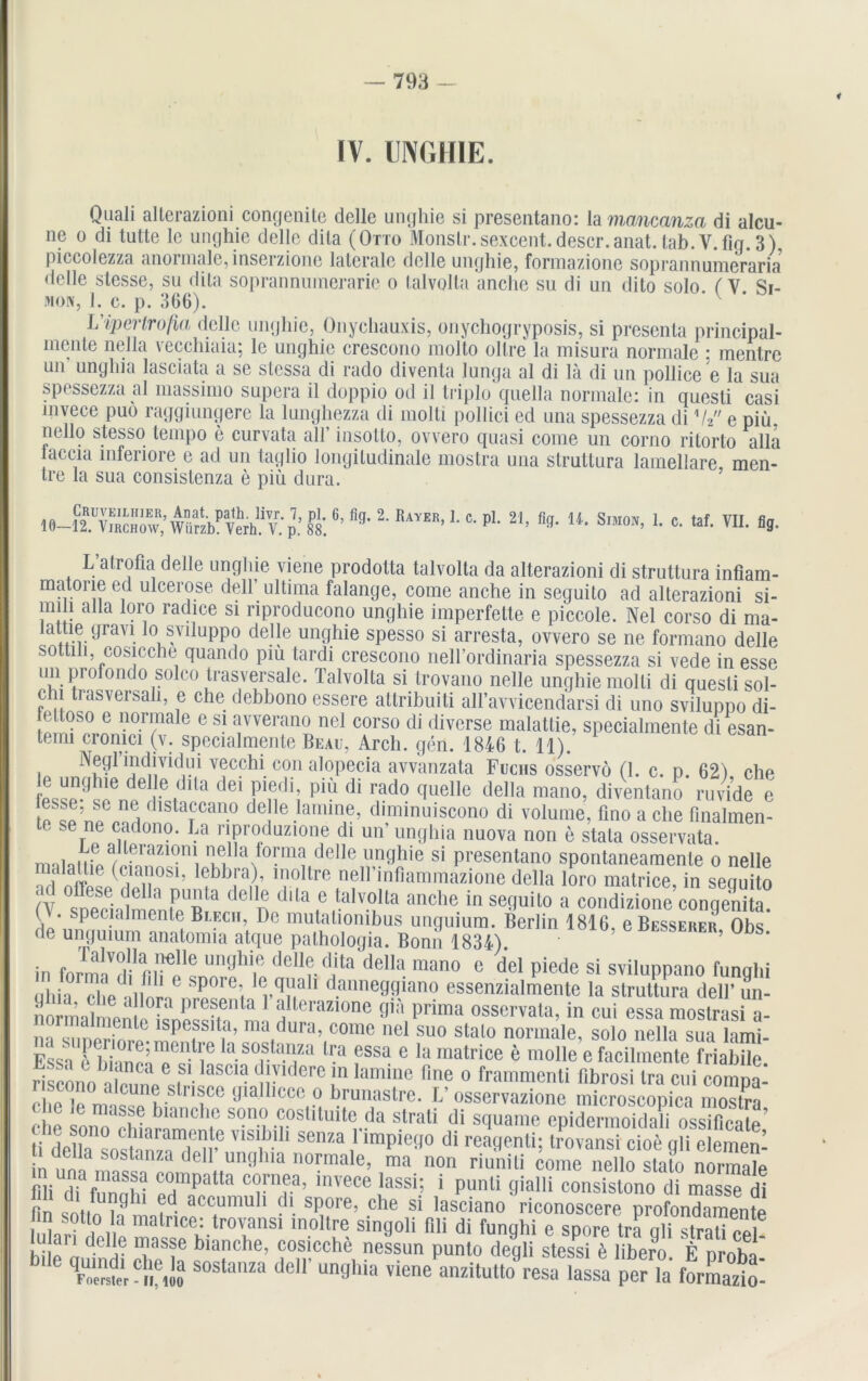 IV. UNGHIE. Quali alterazioni congenite delle unghie si presentano: la mancanzci di alcu- ne o di tutte le unghie delle dila (Otto Monslr.sexccnt.descr.anat. lab. V.fiq. 3), piccolezza anormale, inserzione laterale delle unghie, formazione soprannumeraria, delle slesse, su dita soprannumerarie o talvolla anche su di un dito solo (V Si- mon, 1. c. p. 366). Uiperlrofia delle unghie, Onychauxis, onychogryposis, si presenta principal- inente nella vecchiaia; le unghie crescono molto ollre la misura normale : mentrc un unghia lasciata a se slcssa di rado diventa lunga al di lä di un pollice e la sua spessezza al massimo supera il doppio od il triplo quella normale: in quesli casi mvece puo raggiungere la lunghezza di molti pollici ed una spessezza di'!{' e piü. nello stesso lempo e curvata all’ insotto, ovvero quasi come un corno ritorto alla laccia inferiore e ad un taglio longitudinale mostra una struttura lamellare men- tre la sua consislenza e piü dura. ’ 88*.%* 2* 1!AV'!',’ '• C- pl- 21’ “• Smm’ c' ,af- ««• L atrofla delle unghie viene prodotta talvolta da alterazioni di struttura infiam- matone ed ulcerose dell’ ultima falange, come anche in seguito ad alterazioni si- mi l alla loro radice si riproducono unghie imperfette e piccole. Nel corso di ma- lattie gravi lo sviluppo delle unghie spesso si arresta, ovvero se ne formano delle sottili, cosicche quando piü tardi crescono neH’ordinaria spessezza si vede in esse un profondo solco trasversale. Talvolta si trovano nelle unghie molti di quesli sol- p i trasversali, e che debbono essere attribuiti alTavvicendarsi di uno sviluppo di- el toso e normale e si avverano nel corso di diverse malatlie, specialmente di esan- temi cronici (v. specialmente Beau, Arcli. gen. 1846 t. 11). . Negl individui vecchi con alopecia avvanzata Fuchs osservo (1. c. p. 62) che e unghie delle dila dei piedi, piü di rado quelle della mano, diventano ruvide e e, f dlstaccano delle lamme, diminuiscono di volume, fino a che finalmen- ' ^erne cadono. La nproduzione di un’ unghia nuova non e stata osservata. rnalniiiiri^10111! mlIa fo™ia delle unghie si presentano spontaneamenle o nelle . lallie (cianosi, lebbra), inoltre neH’infiammazione della loro matrice, in sequito ad offese della punta delle dila e talvolta anche in seguito a condizione congenita? ( . specialmenle Bi.ech, De mutalionibus unguium. Berlin 1816, e Besserer Obs de unguium anatomia atque pathologia. Bonn 1834) ’ UDS* in formal!1 mf!1 Tjhi.° dell?-dita della mano e del Piede si sviluppano funghi uhh clic • Uni P°ie’, rqii!a 1 dailneggiano essenzialmente la struttura dell’ un- normalmen e°[^ ^ erazione gia Prima osservata, in cui essa mostrasi a- m s.iDcrim'p6^PefSltia’ madura’ come ncl suo stalo normale, solo nella sua lami- Essa l hi'ir p’ - i0 aS°,S an1za ll’a essa e la raatrice e molle e facilmente friabile rTsfonot^6. aSCia nmdere J11 lamine o frammenti fibrosi tra cui compa! ehe ’p m Cun?-S n?ce Pia icce 0 brunastre. L osservazione microscopica mostra ehe je masse bianche sono costitniie Hn ctroti m • , .„usira’ „„„ iiuituaio, nid nun riuiiiu come nello slato normale flli dffunnW Ä Tf’ inTece ,lassi’ j P™“ 9l«M consislono di masse di fin sntin i’ i •  dl. spoie, che si lasciano riconoscere profondamente imo j u malrice: trovansi inoltre singoli fili di funghi e spore tra qli strati cel! hilaiaC,C m TT blanche’ ^sieche nessun punto degli stessi ü libero. E proba- FUoiCiieiIj soslanza delP unghia viene anzitutto resa lassa per la formazio-