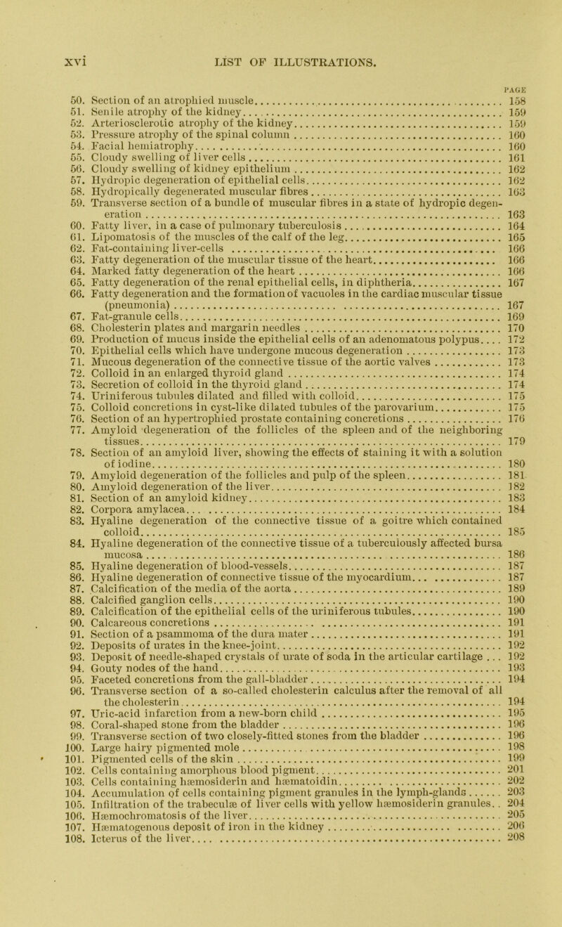 PAGE 50. Seclion of an atropliied nniscle 158 51. Senile atrophy of tlie kidney 159 52. Arteriosclerotic atropliy of the kidney 159 53. Pressure atropliy of tlie spinal coluinn 160 54. Facial hemiatropliy • 160 55. Clondy swelling of liver cells 161 56. Cloudy swelling of kidney epitkelium 162 57. Hydropic degeneration of epithelial cells 162 58. Hydropically degenerated muscular fibres 163 59. Transverse section of a bündle of muscular fibres in a state of liydropic degen- eration 163 60. Fatty liver, in a case of pulmonary tuberculosis 164 61. Lipomatosis of the muscles of the calf of the leg 165 62. Fat-containing liver-cells 166 63. Fatty degeneration of the muscular tissue of the heart 166 64. Marked fatty degeneration of the heart 166 65. Fatty degeneration of the renal epithelial cells, in diphtheria 167 66. Fatty degeneration and the formation of vacuoles in the cardiac muscular tissue (pneumonia) 167 67. Fat-granule cells 169 68. Cholesterin plates and margarin needles 170 69. Production of mucus inside the epithelial cells of an adenomatous polypus... . 172 70. Epithelial cells wliich have undergone mucous degeneration 173 71. Mucous degeneration of the connective tissue of the aortic valves 173 72. Colloid in an enlarged thyroid gland 174 73. Secretion of colloid in the thyroid gland 174 74. Uriniferous tubules dilated and filled witli colloid 175 75. Colloid concretions in cyst-like dilated tubules of the parovarium 175 76. Section of an hypertrophied prostate containing concretions 176 77. Amyloid degeneration of the follicles of the spieen and of the neighboring tissues 179 78. Section of an amyloid liver, showing the effects of staining it with a solution of iodine „ 180 79. Amyloid degeneration of the follicles and pulp of the spieen 181 80. Amyloid degeneration of the liver 182 81. Section of an amyloid kidney 183 82. Corpora amylacea 184 83. Hyaline degeneration of the connective tissue of a, goitre which contained colloid 185 84. Hyaline degeneration of the connective tissue of a tubercuiously affected bursa mucosa 186 85. Hyaline degeneration of blood-vessels 187 86. Hyaline degeneration of connective tissue of the myocardium 187 87. Calcification of the media of the aorta 189 88. Calcified ganglion cells 190 89. Calcification of the epithelial cells of the uriniferous tubules 190 90. Calcareous concretions 191 91. Section of a psammoma of the dura mater 191 92. Deposits of urates in the knee-joint 192 93. Deposit of needle-sliaped crystals of urate of soda in the articnlar cartilage ... 192 94. Gouty nodes of the hand 193 95. Faceted concretions from the gall-bladder 194 96. Transverse section of a so-called Cholesterin calculus after the removal of all the Cholesterin 194 97. Uric-acid infarction from a new-born cliild 195 98. Coral-shaped stone from the bladder 196 99. Transverse section of two closely-fitted stones from the bladder 196 100. Large hairy pigmented mole 198 101. Pigmented cells of the skin 199 102. Cells containing amorphous blood pigment 201 103. Cells containing lisemosiderin and hsematoidin 202 104. Accumulation of cells containing pigment granules in the lymph-glands 203 105. Infiltration of the trabeculse of liver cells with yellow lifemosiderin granules. . 204 106. Hsemocliromatosis of the liver 205 107. Hsematogenous deposit of iron in the kidney 206 108. Icterus of the liver 208