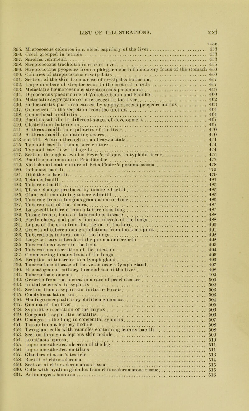 PAGE 395. Micrococcus colonies in a blood-capillary of the liver 453 396. Cocci grouped in tetrads 453 397. Sarcina ventriculi 453 398. Streptococcus tracheitis in scarlet fever 455 399. Streptococcus pyogenes from a plilegmonous inflammatory focus of the storuach 456 400. Colonies of Streptococcus erysipelatis 456 401. Section of the skin from a case of erysipelas bullosum 457 402. Large numbers of Streptococcus in tlie pectoral umscle 457 403. Metastatic htematogenous Streptococcus pneumonia 458 404. Diplococcus pneumoniae of Weichselbaum and Frankel 460 405. Metastatic aggregation of micrococci in the liver 462 406. Endocarditis pustulosa caused by stapliylococcus pyogenes aureus 463 407. Gonococci in the secretion from the urethra 464 408. Gonorrhceal uretliritis 464 409. Bacillus subtilis in different stages of development 467 410. Clostridium butyricum 467 411. Anthrax-bacilli in capillaries of the liver 470 412. Anthrax-bacilli containing spores 470 413 and 414. Section through an anthrax-pustule 471 415. Typhoid bacilli from a pure culture 474 416. Typhoid bacilli with flagella 474 417. Section through a swollen Peyer’s plaque, in typhoid fever 475 418. Bacillus pneumoniae of Friedländer 477 419. Nail-shaped stab-culture of Friedländer’s pneumococcus 478 420. Influenza-bacilli .... 479 421. Diphtheria-bacilli 479 422. Tetanus-bacilli 481 423. Tubercle-bacilli 485 424. Tissue clianges produced by tubercle-bacilli 485 425. Giant cell containing tubercle-bacilli 485 426. Tubercle from a fungous gränulation of bone 486 427. Tuberculosis of the pleura 487 428. Large-cell tubercle from a tuberculous lung 487 429. Tissue from a focus of tuberculous disease 488 430. Partly cheesy and partly fibrous tubercle of the lungs 488 431. Lupus of the skin from the region of the knee 490 432. Growth of tuberculous granulations from the knee-joint 491 433. Tuberculous induration of the lungs 492 434. Large solitary tubercle of the pia mater cerebelli 492 435. Tuberculous cavern in the tibia 493 436. Tuberculous ulceration of the intestine 494 437. Commencing tuberculosis of the lungs 495 438. Eruption of tubercles in a lymph-gland 496 439. Tuberculous disease of the veins near a lympli-gland 497 440. Haematogenous miliary tuberculosis of the liver 498 441. Tuberculosis omenti 499 442. Growths from the pleura in a case of pearl-disease 500 443. Initial sclerosis in sypliilis 502 444. Section from a syphilitic initial sclerosis 503 445. Condyloma latum an i 503 446. Meningo-encephalitis syphilitica gummosa 504 447. Gumma of the liver 505 448. Syphilitic ulceration of the larynx 506 449. Congenital syphilitic hepatitis 506 450. Changes in the lung in congenital Syphilis 507 451. Tissue from a leprosy nodule 508 452. Two giant cells with vacuoles containing leprosy bacilli 508 453. Section through a leprous skin-nodule 509 454. Leontiasis leprosa 510 455. Lepra antestlietica ulcerosa of the leg 511 456. Lepra ansesthetlca mutilans 511 457. Glanders of a cat’s testicle 513 458. Bacilli ot rhinoscleroma 514 459. Section of rhinoscleromatous tissue 515 460. Cells with hyaline globules from rhinoscleromatous tissue 515 461. Actinomyces hominis 516