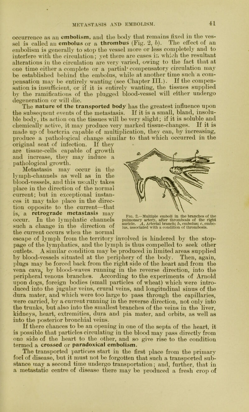 occurrence as an embolism, and tlie body tliat remains fixed in tlie ves- sei is called an embolus or a thrombus (Fig. 2, b). Tlie eli'ect of an embolism is generally to stop tlie vessel more or less completely and to interfere witli tlie circulation; yet tliere are cases in which tlie resultant alterations in tlie circulation are very varied, owing to tlie fact tliat at one time eitlier a complete or a partial* compensatory circulation may be establislied beliind tlie embolus, wliile at anotlier time such a com- pensation may be entirely wanting (see Cliapter III.)- If tlie compen- sation is insufiicient, or if it is entirely wanting, tlie tissues supplied by tlie ramifications of tlie plugged blood-vessel will eitlier undergo degeneration or will die. The natu re of the transported body has tlie greatest influence upon the subsequent events of the metastasis. If it is a small, bland, insolu- ble body, its action on the tissues will be very slight; if it is soluble and chemically active, it may produce verjT marked tissue-clianges. If it is made up of bacteria capable of multiplication, they can, by increasing, produce a patliological cliange similar to tliat which occurred in the original seat of infection. If they are tissue-cells capable of growtli and increase, they may induce a l^athological growth. Metastasis may occur in the lymph-cliannels as well as in the blood-vessels, and tliis usually takes place in the direction of tlie normal current; but in exceptional instan- ces it may take place in the direc- tion opposite to the current—tliat is, a retrograde metastasis may occur. In the lympliatic cliannels such a cliange in tlie direction of the current occurs wlien the normal escape of ly mph from the territory involved is liindered by the stop- page of tlie lymphatics, and the lympli is thus compelled to seek otlier outlets. A similar condition may be produced in limited areas supplied by blood-vessels situated at the periphery of the body. Tlien, again, plugs may be forced back from the right side of the lieart and from the vena cava, by blood-waves running in the reverse direction, into the peripheral venous branclies. According to the experiments of Arnold upon dogs, foreign bodies (small particles of wheat) which were intro- duced into the jugular veins, crural veins, and longitudinal sinus of the dura mater, and which were too large to pass through the capillaries, were carried, by a current running in the reverse direction, not onlv into the trunks, but also into the smallest branclies of the veins in the liver, kidneys, lieart, extremities, dura and pia mater, and orbits, as well as into the posterior bronchial veins. If tliere chances to be an opening in one of the septa of the lieart, it is possible tliat particles circulating in the blood may pass directly from one side of the lieart to the otlier, and so give rise to tlie condition termed a crossed or paradoxical embolism. The transported particies start in the first place from the primary foci of disease, but it must not be forgotten tliat such a transported sub- stance may a second time undergo transportation; and, furtlier, tliat in a metastatic centre of disease tliere may be produced a fresh crop of Fig. 2.—Multiple emboli in the branches of the pulmonary artery, after thrombosis of the right auricle. A, Arterial branch; b, embolus; c, embo- lus, associated with a condition of thrombosis.