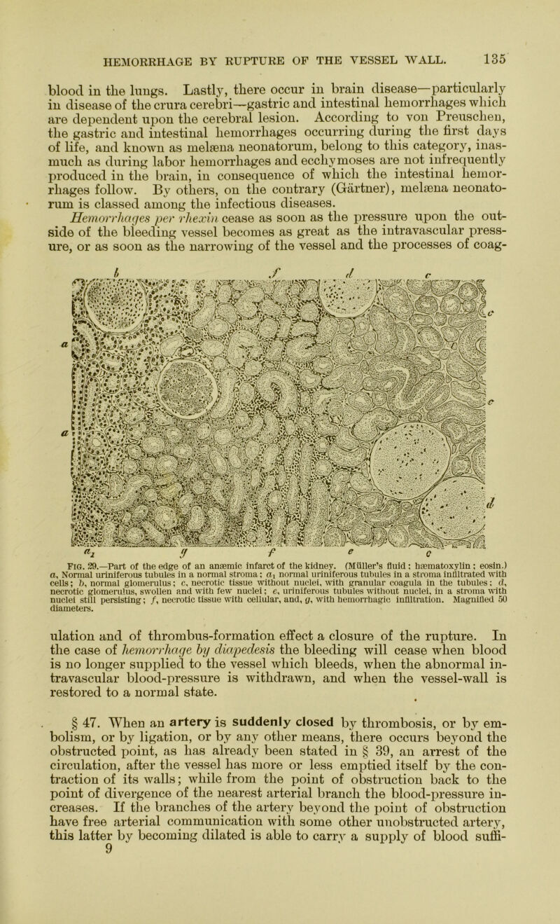 bloocl in tlie lungs. Lastly, tliere occur in brain disease—particularly in disease of tlie crura cerebri—gastric and intestinal liemorrliages wliich are dependent npon tlie cerebral lesion. According to von Preuschen, tlie gastric and intestinal liemorrliages occurring during tlie first days of life, and known as melsena neonatorum, belong to tliis category, inas- mucli as during labor liemorrliages and eccliymoses are not infrequently produced in tlie brain, in consequence of wliich tlie intestinal liemor- rliages follow. By otliers, on tlie contrary (Gärtner), melsena neonato- rum is classed among tlie infectious diseases. Hemorrliages per rhexin cease as soon as tlie pressure upon tlie out- side of tlie bleeding vessel becomes as great as tlie intravascular press- ure, or as soon as tlie narrowing of tlie vessel and tlie processes of coag- Fig. 29.—Part of the edge of an anaemic infarct of the kidney. (Müller’s fluid; hmmatoxylin ; eosin.) a, Normal uriniferous tubules in a normal stroma; ai normal uriniferous tubules in a Stroma inliltrated witb cells; b, normal glomerulus; c, necrotie tissue witbout nuclei, with granulär coagula in tbe tubules; cl, necrotic glomerulus, swollen and with few nuclei; e, uriniferous tubules without nuclei, in a stroma with nuclei still persisting; /, necrotic tissue with cellular, and, g, with hemorrhagic inflltration. Magnifled 50 diameters. ulation and of thrombus-formation effect a closure of tlie rupture. In the case of hemorrhage by diapedesis tlie bleeding will cease wlien blood is no longer supplied to the vessel wliich bleeds, wlien the abnormal in- travascular blood-pressure is withdrawn, and when the vessel-wall is restored to a normal state. • § 47. When an artery is suddenly closed by thrombosis, or by em- bolism, or by ligation, or by any otlier means, tliere occurs beyond the obstructed point, as lias already been stated in § 39, an arrest of the circulation, after the vessel has more or less emptied itself by the con- traction of its walls; wliile from the point of obstruction back to the point of divergence of the nearest arterial brancli tlie blood-pressure in- creases. If the branches of the artery beyond the point of obstruction have free arterial communication with some otli6r unobstructed artery, this latter by becoming dilated is able to carrv a supply of blood suffi- 9