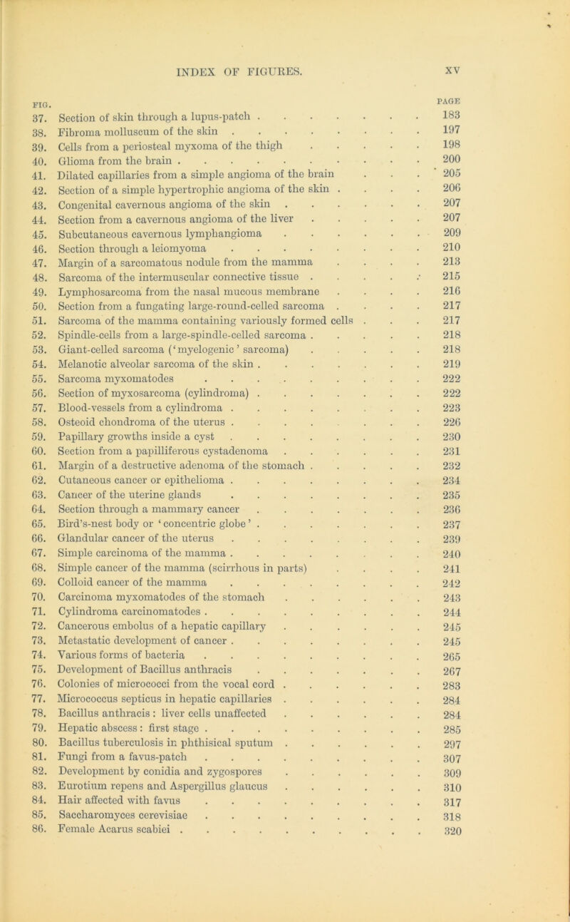 FIG. PAGE 37. Section of skin through a lupus-patch 183 38. Fibroma molluscum of the skin 197 39. Cells from a periosteal myxoma of the thigh 198 40. Glioma from the brain 200 41. Dilated capillaries from a simple angioma of the brain . . . 205 42. Section of a simple hypertrophic angioma of the skin .... 20G 43. Congenital cavernous angioma of the skin 207 44. Section from a cavernous angioma of the liver 207 45. Subcutaneous cavernous lymphangioma 209 46. Section through a leiomyoma 210 47. Margin of a sarcomatous nodule from the mamma .... 213 48. Sarcoma of the intermuscular connective tissue • 215 49. Lymphosarcoma from the nasal mucous membrane .... 216 50. Section from a fungating large-round-celled sarcoma . . . . 217 51. Sarcoma of the mamma containing variously formed cells . . . 217 52. Spindle-cells from a large-spindle-celled sarcoma ..... 218 53. Giant-celled sarcoma (‘myelogenic ’ sarcoma) ..... 218 54. Melanotic alveolar sarcoma of the skin 219 55. Sarcoma myxomatodes ......... 222 56. Section of myxosarcoma (cylindroma) 222 57. Blood-vessels from a cylindroma 223 58. Osteoid chondroma of the uterus ....... 226 59. Papillary growths inside a cyst . 230 60. Section fi'orn a papilliferous cystadenoma . . . . . . 231 61. Margin of a destructive adenoma of the stomach ..... 232 62. Cutaneous cancer or epithelioma 234 63. Cancer of the uterine glands 235 64. Section through a mammary cancer 236 65. Bird’s-nest body or ‘ concentric globe ’ . . . . . . . 237 66. Glandular cancer of the uterus 239 67. Simple carcinoma of the mamma ........ 240 68. Simple cancer of the mamma (scirrhous in parts) .... 241 69. Colloid cancer of the mamma 242 70. Carcinoma myxomatodes of the stomach 243 71. Cylindroma carcinomatodes 244 72. Cancerous embolus of a hepatic capillary 245 73. Metastatic development of cancer 245 74. Various forms of bacteria 265 75. Development of Bacillus anthracis 267 76. Colonies of microcoeci from the vocal cord 283 77. Micrococcus septicus in hepatic capillaries 284 78. Bacillus anthracis : liver cells unaffected 284 79. Hepatic abscess : first stage 285 80. Bacillus tuberculosis in phthisical sputum 297 81. Fungi from a favus-patch 307 82. Development by conidia and zygospores 309 83. Eurotium repens and Aspergillus glaucus 310 84. Hair affected with favus 317 85. Saccharomyces cerevisiae 318 86. Female Acarus scabiei 320