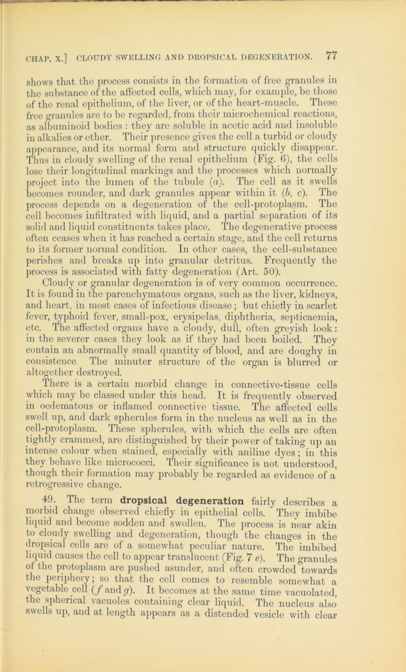 shows that the process consists in the formation of free granules in the substance of the affected cells, wliich may, for example, be those of the renal epithelium, of the liver, or of the heart-muscle. These free granules are to be regarded, from their microchemical reactions, as albuminoid bodies : they are soluble in acetic acid and insoluble in alkalies or ether. Their presence gives the cell a turbid or cloudy appearance, and its normal form and structure quickly disappear. Thus in cloudy swelling of the renal epithelium (Fig. 6), the cells lose their longitudinal markings and the processes which normally project into the lumen of the tubule (ci). The cell as it swells becomes rounder, and dark granules appear within it (b, c). The process depends on a degeneration of the cell-protoplasm. The cell becomes infiltrated with liquid, and a partial Separation of its solid and liquid constituents takes place. The degenerative process often ceases when it has reached a certain stage, and the cell returns to its former normal condition. In other cases, the cell-substance perishes and breaks up into granulär detritus. Frequently the process is associated with fatty degeneration (Art. 50). Cloudy or granulär degeneration is of very common occurrence. It is found in the parenchymatous organs, such as the liver, kidneys, and heart, in most cases of infectious disease ; but chiefly in scarlet fever, typhoid fever, small-pox, erysipelas, diphtheria, septicaemia, etc. The affected organs have a cloudy, dull, often greyish look: in the severer cases they look as if they had been boiled. They contain an abnormally small quantity of blood, and are doughy in consistence. The minuter structure of the organ is blurred or altogether destroyed. There is a certain morbid change in connective-tissue cells which may be classed under this head. It is frequently observed in oedematous or inflamed connective tissue. The affected cells swell up, and dark spherules form in the nucleus as well as in the cell-protoplasm. These spherules, with which the cells are often tightly crammed, are distinguished by their power of taking up an intense colour when stained, especially with aniline dyes; in this they behave like micrococci. Their significance is not understood, though their formation may probably be regarded as evidence of a rctrogressive change. 40. The term dropsical degeneration fairly describes a morbid change observed chiefly in epithelial cells. ' They imbibe liquid and become sodden and swollen. The process is near akin to cloudy swelling and degeneration, though the changes in the dropsical cells are of a somewhat peculiar nature. The imbibed liquid causes the cell to appear translucent (Fig. 7 e). The granules of the protoplasm are pushed asunder, and often crowded towards the peiipheiy; so that the cell comes to resemble somewhat a vegetable cell (/andg). It becomes at the same time vacuolated, the spherical vacuoles containing clear liquid. The nucleus also swells up, and at length appears as a distended vesicle with clear