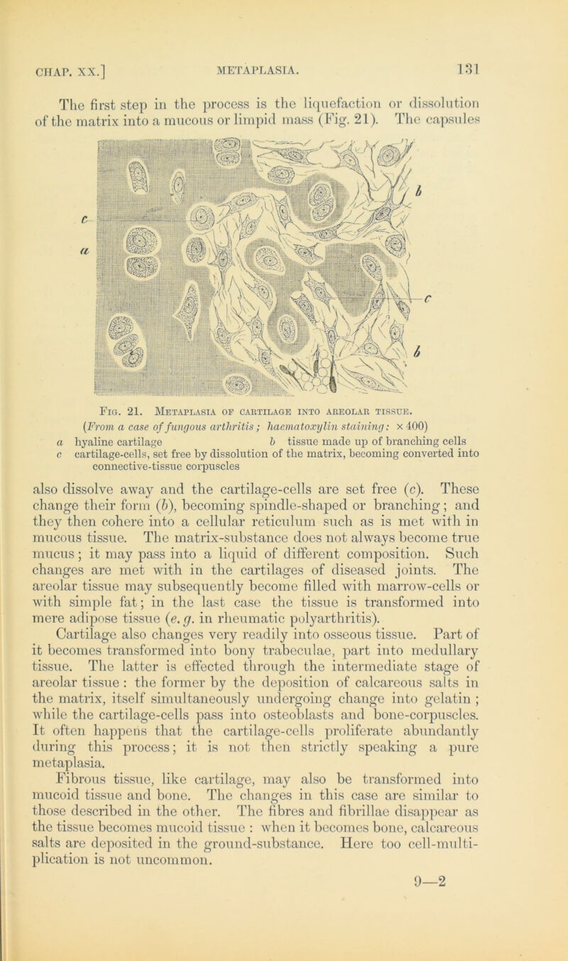 The first step in the process is the liquefaction or dissolution of the matrix into a mucous or limpid mass (Fig. 21). The capsul es Fig. 21. Metaplasia of cartilage into areolar tissue. (From a case offungous arthritis; haematoxylin staining: x 400) a hyaline cartilage b tissue made up of branehing cells c cartilage-cells, set free by dissolution of tbe matrix, becoming converted into connective-tissue corpuscles also dissolve away and the cartilage-cells are set free (c). These change their form (b), becoming spindle-shaped or branehing; and they then cohere into a cellular reticulum such as is met with in mucous tissue. The matrix-substance does not always become true mucus; it may pass into a liquid of different composition. Such changes are met with in the cart.ilages of diseased joints. The areolar tissue may subsequently become filled with marrow-cells or with simple fat; in the last case the tissue is transformed into mere adipöse tissue (e. g. in rheumatic polyarthritis). Cartilage also changes very readily into osseous tissue. Part of it becomes transformed into bony trabeculae, part into medullary tissue. The latter is effected through the intermediate stage of areolar tissue : the former by the deposition of calcareous salts in the matrix, itself simultaneously undergoing change into gelatin ; while the cartilage-cells pass into osteoblasts and bone-corpuscles. It often happens that the cartilage-cells proliferate abundantly during this process; it is not then strictly speaking a pure metaplasia. Fibrous tissue, like cartilage, may also be transformed into mucoid tissue and bone. The changes in this case are similar to those described in the other. The fibres and fibrillae disappear as the tissue becomes mucoid tissue : when it becomes bone, calcareous salts are deposited in the ground-substance. Here too cell-multi- plication is not uncommon. 0—2