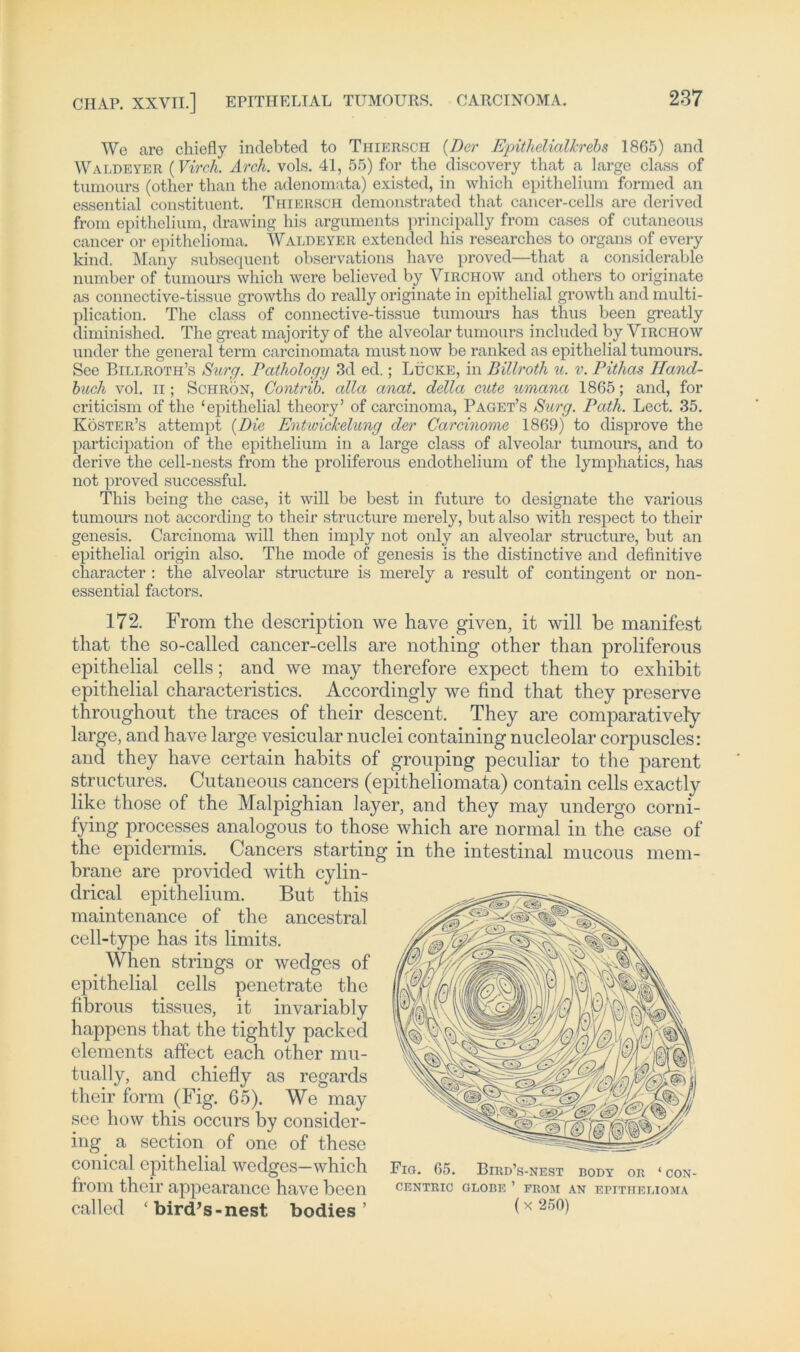 We are chiefly inclebted to Thiersch {Der Epithelialkrebs 1865) and Waldeyer (Virch. Arch. vols. 41, 55) for the discovery that a large dass of tumours (other than the adenomata) existed, in which epithelium formed an essential constituent. Thiersch demonstrated that cancer-cells are derived from epithelium, drawing his arguments principally from cases of cutaneous cancer or epithelioma. Waldeyer extended his researches to organs of every kind. Many subsequent observations have proved—that a considerable nurnber of tumours which were believed by Virchow and others to originate as connective-tissue growths do really originate in epithelial growth and multi- plication. The dass of connective-tissue tumours has thus been greatly diminished. The great majority of the alveolar tumours included by Virchow under the general term carcinomata must now be ranked as epithelial tumours. See Billroth’s Surg. Pathology 3d ed.; Lucke, in Billroth u. v. Pithas Hand- buch vol. ii; Schrön, Gontrib. alla anat. della cute umana 1865; and, for criticism of the ‘epithelial theory’ of carcinoma, Paget’s Surg. Path. Lect. 35. Koster’s attempt {Die Entwickelung der Carcinome 1869) to disprove the participation of the epithelium in a large dass of alveolar tumours, and to derive the cell-nests from the proliferous endothelium of the lymphatics, has not proved successful. This being the case, it will be best in future to designate the various tumours not aceording to their structure merely, but also witli respect to their genesis. Carcinoma will then imply not only an alveolar structure, but an epithelial origin also. The mode of genesis is the distinctive and definitive character : the alveolar structure is merely a result of contingent or non- essential factors. 172. From the description we have given, it will be manifest that the so-called cancer-cells are nothing other than proliferous epithelial cells; and we may therefore expect them to exhibit epithelial characteristics. Accordingly we find that they preserve throughout the traces of their descent. They are comparatively large, and have large vesicular nuclei containing nucleolar cor|3uscles: and they have certain habits of grouping peculiar to the parent structures. Cutaneous cancers (epitheliomata) contain cells exactly like those of the Malpighian layer, and they may undergo corni- fying processes analogous to those which are normal in the case of the epidermis. . Cancers starting in the intestinal mucous mem- brane are provided with cylin- drical epithelium. But this maintenance of the ancestral cell-type has its limits. When striügs or wedgcs of epithelial cells penetrate the fibrous tissues, it invariably happens that the tightly packed clements affect each other mu- tual ly, and chiefly as regards their form (Fig. 65). We may see how this occurs by consider- ing a section of one of these conical epithelial wedges-which Fig. 65. Bird’s-nest body or ‘con- from their appearance have been centric olobe ’ from an epithelioma called ‘bird’s-nest bodies ’ (x 250)