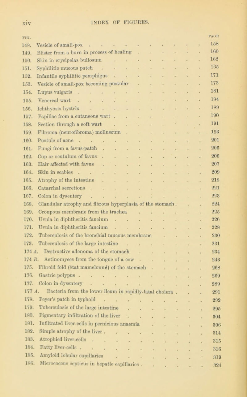 FIG. PAGE 148. Vesicle of small-pox 158 149. Blister from a burn in process of healing 109 150. Skin in erysipelas bullosum ........ 102 151. Syphilitic mucous patch 105 152. Infantile syphilitic pemphigus 171 153. Vesicle of small-pox becoming pustular 173 154. Lupus vulgaris 181 155. Venereal wart 184 150. Ichthyosis hystrix 189 157. Papillae from a cutaneous wart 190 158. Section through a soft wart ‘ 101 159. Fibroma (neurofibroma) molluscum 193 100. Pustule of acne 201 161. Fungi from a favus-patch 200 162. Cup or scutulum of favus 206 163. Hair affected with favus 207 164. Skin in scabies ........... 209 165. Atrophy of the intestine ......... 218 166. Catarrhal secretions 221 107. Colon in dysentery .......... 223 168. Glandular atrophy and fibrous hyperplasia of the stomach . . . 224 109. Croupous membrane from the trachea 225 170. Uvula in diphtheritis faucium ........ 220 171. Uvula in diphtheritis faucium 228 172. Tuberculosis of the bronchial mucous membrane .... 230 173. Tuberculosis of the large intestine ....... 231 174 A. Destructive adenoma of the stomach 234 174 B. Actinomyces from the tongue of a cow 243 175. Fibroid fold (6tat mamelonnö) of the stomach 208 170. Gastric polypus 209 177. Colon in dysentery 289 177 A. Bacteria from the lower ileum in rapidly-fatal cholera . . . 291 178. Peyer’s patch in typhoid 292 179. Tuberculosis of the large intestine 295 180. Pigmentary infiltration of the liver 304 181. Infiltrated liver-cells in pernicious anaemia 306 182. Simple atrophy of the liver 183. Atrophied liver-cells 184. Fatty liver-cells 185. Amyloid lobular capillaries 3x9 180. Micrococcus septicus in hepatic capillaries 324