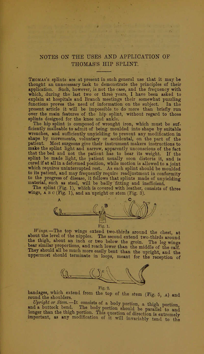 NOTES ON THE USES AND APPLICATION OF THOMAS’S HIP SPLINT. Thomas’s splints are at present in such general use that it may bo thought an unnecessary task to demonstrate the principles of their application. Such, however, is not the case, and the frequency with which,, .during the last two or three years, I have been asked to explain at hospitals and Branch meetings their somewhat puzzling functions proves the need of information on the subject. In the present article it will be impossible to do more than briefly run over the main features of the hip splint, without regard to those splints designed for the knee and ankle. The hip splint is composed of wrought iron, which must be suf- ficiently malleable to admit of being moulded into shape by suitable wrenches, and sufficiently unyielding to prevent any modification in shape by movements, voluntary or accidental, on the part of the patient. Most surgeons give their instrument makers instructions to make the splint light and narrow, apparently unconscious of the fact that the bed and not the patient has to bear its weight. If the splint be made light, the patient usually soon distorts it, and is cured if at all in a deformed position, while motion is allowed to a joint which requires uninterrupted rest. As each splint should be moulded to its patient, and may frequently require readjustment in conformity to the progress of disease, it follows that splints made of unyielding material, such as steel, \^^1 be badly fitting and inefficient. The splint (Fig. 1), which is covered with leather, consists of three wings, ABC (Fig. 1), and an upright or stem (Fig. 3). Fig. 1. Wings.—The wings extend two-thirds around the cheat, at nipples. The second extend two-thirds around the thigh, about an inch or two below the groin. The leg wings bear similar proportions, and reach lower than the middle of the calf. They should all be much more easily bent than the upright, and the uppermost should terminate in loops, meant for the reception of Pig. 2. bandages, which extend from the top of the stem (Fig 5 a1 and round the shoulders. \ / Upright or Stem.-lt a body portion, a thigh portion, and a buttock bend The body portion should be parallel to and longer than the thigh portion. This question of direction is extremely important, as any modification of it will invariably tend to the