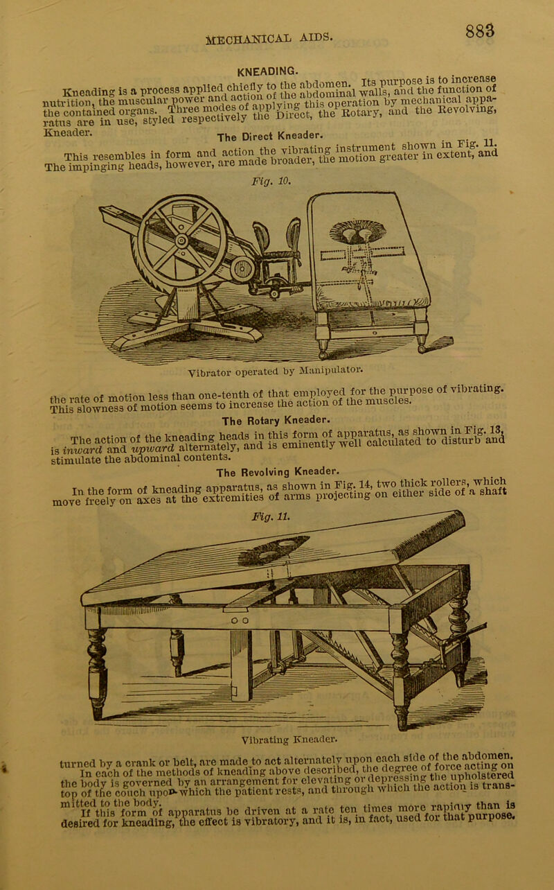 885 kneading. Kneading is a process appiied ohiefly to the abdomen^ function of thP^nh’fct^^the^R^ ^Zu^^h^^evoVnngj Its purpose is to increase Kneader. The Direct Kneader. The^mpin^hig'heads, hcwever^ar^mad^broad^ an<^ Fig. 10. Vibrator operated by Manipulator. The Rotary Kneader. „ jssffsss stimulate the abdominal contents. The Revolving Kneader. Fig. 11. Vibrating Kneader. turned by a crank or belt, are made to act alternately upon each sWe o| ttanMMjen. In each of the methods of kneading above described, lh® d^g1 ee „J°P ,mhol9tered the bodv is governed by an arrangement for elevating ov depressing.thei tiphoisterea top of the couch upoP-which the patient rests, and through which the action is trans mitIMh<istlformdof apparatus be driven at a rate tenA1?®*8 i^ed^oi^that^urpose! desired for kneading, the effect is vibratory, and it is, m fact, used foi t . p P