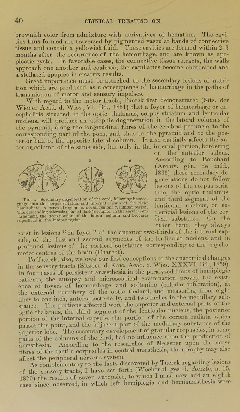 brownish color from admixture with derivatives of hematine. The cavi- ties thus formed are traversed by pigmented vascular bands of connective tissue and contain a yellowish fluid. These cavities are formed within 2-3 months after the occurrence of the hemorrhage, and are known as apo- plectio cysts. In favorable cases, the connective tissue retracts, the walls approach one another and coalesce, the capillaries become obliterated and a stellated apoplectic cicatrix results. Great importance must be attached to the secondary lesions of nutri- tion which are produced as a consequence of hsemorrhage in the paths of transmission of motor and sensory impulses. With regard to the motor tracts, Tuerck first demonstrated (Sitz, der Wiener Acad. d. Wiss., VI. Bd., 1851) that a foyer of hmmorrhage or en- cephalitis situated in the optic thalamus, corpus striatum and lenticular nucleus, will produce an atrophic degeneration in the lateral coluinns of the pyramid, along the longitudinal fibres of the cerebral peduncle to the corresponding part of the pons, and thus to the pyramid and to the pos- terior half of the opposite lateral column. It also partially affects the an- terior_column of the same side, but only in the internal portion, bordering on the anterior sulcus. According to Bouchard (Archiv, gen. de med., 18GG) these secondary de- generations do not follow lesions of the corpus stria- tum, the optic thalamus, and third segment of the lenticular nucleus, or su- perficial lesions of the cor- tical substance. On the other hand, they always exist in lesions “ en foyer ” of the anterior two-thirds of the internal cap- sule, of the first and second segments of the lenticular nucleus, and in profound lesions of the cortical substance corresponding to the psycho- motorcentres of the brain (Charcot). To Tuerck, also, we owe our first conceptions of the anatomical changes in the sensory tracts (Sitzber. d. Kais. Acad. d. Wiss. XXXVI. Bd., 1859). In four cases of persistent anmsthesia in the paralyzed limbs of hemipl'egio patients, the autopsy and microscopical examination proved the exist- ence of foyers of hmmorrhage and softening (cellular Infiltration), at the external periphery of the optic thalami, and measuring from eight lines to one inch, antero-posteriorly, and two inches in the medullary sub- stance. The portions affected were the superior and external parts of the optic thalamus, the third segment of the lenticular nucleus, the posterior portion of the internal capsule, the portion of the corona radiata which nasses this point, and the adjacent part of the medullary substance of the superior lobe. The secondary development of granulär corpuscles, in some parts of the columns of the cord, had no infiuence upon the production of anaesthesia. According to the researches of Meissner upon the nerve fibres of the tactile corpuscles in central ansesthesia, the atrophy rnay also affect the peripheral nervous system. As complementary to the facts discovered by Tuerck regarding lesions of the sensory tracts, I have set forth (Wochenbl. ges d. Aerzte, n. Io, 1870) the results of seven autopsies, to which I must now add an eighth case since observed, in which left hemiplegia and hemiamesthesia were a b c Fig. 1.—Secondary'degeneration o£ the cord, following haämor- rhage into the corpus striatum and internal capsule of the right hemisphere. a, cervical region ; 6, dorsal region; c, lumbar region. The descending sclerosis (shaded dark) occupios, in the cervical en- largement, the deep portion of the lateral column and becomes superficial in the lumbar region.