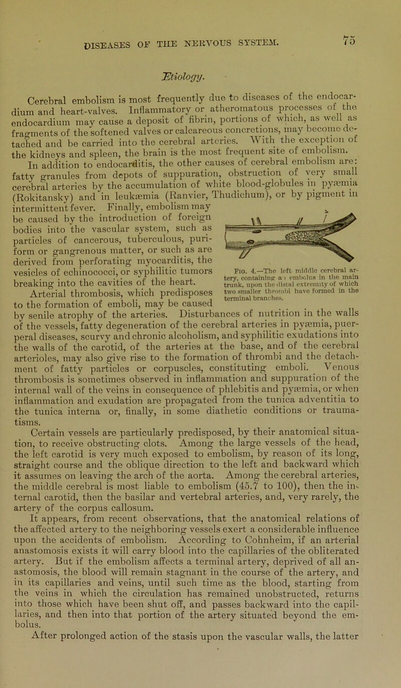 .Etiology. Fio. 4.—Tho left middle cerebral ar- tery, containinpr a i embolus in tlie main trank, upon the distal extremity of which two smailer thrombi have fonned in the terminal branches. Cerebral embolism is most frequently due to diseases of tlie endocar* dium and heart-valves. Inflammatory or atheromatous processes ot the endocardium may cause a deposit of fibnn, portions of which, as well as fragments of thesoftened valves or calcareous concretions, may becomede- tached and be carried. into the cerebral arteriös. W ith the exception ot the kidneys and spieen, the brain is the most frequent site of embolism. In addition to endocarditis, the other causes of cerebral embolism are: fatty granules from depots of suppuration, obstruction of very small cerebral arteries by the accumulation of white blood-globules in pyiemia (Rokitansky) and in leukaemia (Ranvier, Thudichum), or by pigment m intermittent fever. Finally, embolism may be caused by the introduction of foreign bodies into the vascular System, such as particles of cancerous, tuberculous, puri- form or gangrenous matter, or such as are derived from perforating myocarditis, the vesicles of echinococci, or syphilitic tumors breaking into the cavities of the heart. Arterial thrombosis, which predisposes to the formation of emboli, may be caused by senile atrophy of the arteries. Disturbances of nutrition in the walls of the vessels, fatty degeneration of the cerebral arteries in pyiemia, puer- peral diseases, scurvy and chronic alcoholism, and syphilitic exudations into the walls of the carotid, of the arteries at the base, and of the cerebral arterioles, may also give rise to the formation of thrombi and the detach- ment of fatty particles or corpuscles, constituting emboli. V enous thrombosis is sometimes observed in inflammation and suppuration of the internal wall of the veins in consequence of phlebitis and pyiemia, or when inflammation and exudation are propagated from the tunica adventitia to the tunica interna or, finally, in some diathetic conditions or trauma- tisms. Certain vessels are particularly predisposed, by their anatomical Situa- tion, to receive obstructing clots. Among the large vessels of the head, the left carotid is very much exposed to embolism, by reason of its long, straight course and the oblique direction to the left and backward which it assumes on leaving the arch of the aorta. Among the cerebral arteries, the middle cerebral is most liable to embolism (45.7 to 100), then the in- ternal carotid, then the basilar and vertebral arteries, and, very rarely, the artery of the corpus callosum. It appears, from recent observations, that the anatomical relations of the affected artery to the neighboring vessels exert a considerable influence upon the accidents of embolism. According to Cohnheim, if an arterial anastoinosis exists it will carry blood into the capillaries of the obliterated artery. But if the embolism affects a terminal artery, deprived of all an- astomosis, the blood will remain stagnant in the course of the artery, and in its capillaries and veins, until such time as the blood, starting from the veins in which the circulation has remained unobstructed, returns into those which have been shut off, and passes backward into the capil- laries, and then into that portion of the artery situated beyond the em- bolus. After prolonged action of the stasis upon the vascular walls, the latter