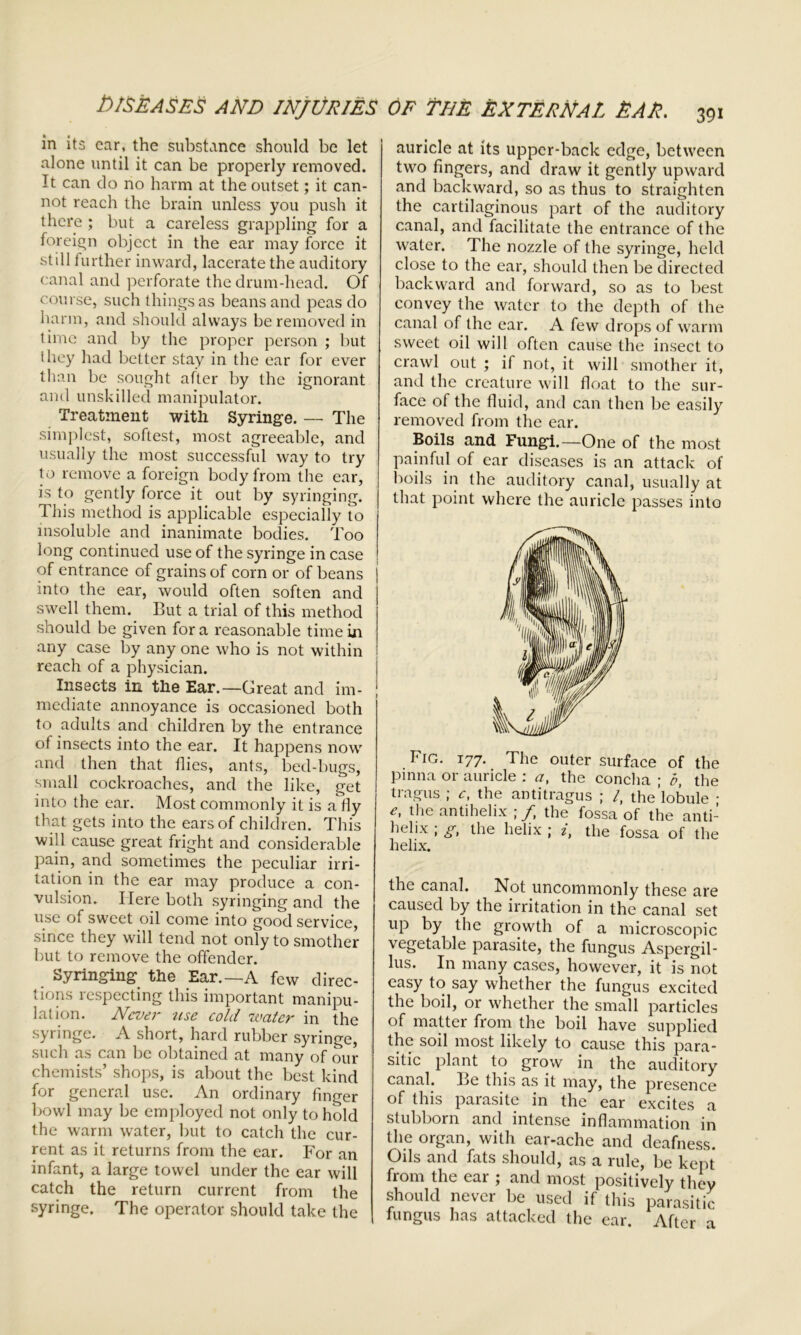 in its car, the substance should be let alone until it can be properly removed. It can do no harm at the outset; it can- not reach the brain unless you push it there ; but a careless grappling for a foreign object in the ear may force it still further inward, lacerate the auditory canal and perforate the drum-head. Of course, such things as beans and peas do harm, and should always be removed in time and by the proper person ; but ihey had better stay in the ear for ever than be sought after by the ignorant anti unskilled manipulator. Treatment with Syringe. — The simplest, softest, most agreeable, and usually the most successful way to try to remove a foreign body from the ear, is to gently force it out by syringing. This method is applicable especially To insoluble and inanimate bodies. Too long continued use of the syringe in case of entrance of grains of corn or of beans into the ear, would often soften and swell them. But a trial of this method should be given for a reasonable time in any case by any one who is not within reach of a physician. Insects in the Ear.—Great and im- mediate annoyance is occasioned both to adults and children by the entrance of insects into the ear. It happens now and then that flies, ants, bed-bugs, small cockroaches, and the like, get into the ear. Most commonly it is a fly that gets into the ears of children. This will cause great fright and considerable pain, and sometimes the peculiar irri- tation in the ear may produce a con- vulsion. Here both syringing and the use of sweet oil come into good service, since they will tend not only to smother but to remove the offender. Syringing the Ear.—A few direc- tions respecting this important manipu- lation. Never use cold zuatcr in the syringe. A short, hard rubber syringe, such as can be obtained at many of our chemists’ shops, is about the best kind for general use. An ordinary finger bowl may be employed not only to hold the warm water, but to catch the cur- rent as it returns from the ear. For an infant, a large towel under the ear will catch the return current from the syringe. The operator should take the auricle at its upper-back edge, between two fingers, and draw it gently upward and backward, so as thus to straighten the cartilaginous part of the auditory canal, and facilitate the entrance of the water. The nozzle of the syringe, held close to the ear, should then be directed backward and forward, so as to best convey the water to the depth of the canal of the ear. A few drops of warm sweet oil will often cause the insect to crawl out ; if not, it will smother it, and the creature will float to the sur- face of the fluid, and can then be easily removed from the ear. Boils and Fungi.—One of the most painful of ear diseases is an attack of boils in the auditory canal, usually at that point where the auricle passes into Fig. 177. The outer surface of the pinna or auricle : a, the concha ; b, the tragus ; c, the antitragus ; /, the’lobule • the antihelix ; /, the fossa of the anti- helix ; g, the helix ; i, the fossa of the helix. the canal. Not uncommonly these are caused by the irritation in the canal set up by the growth of a microscopic vegetable parasite, the fungus Aspergil- lus. In many cases, however, it is not easy to say whether the fungus excited the boil, or whether the small particles of matter from the boil have supplied the soil most likely to cause this para- sitic plant to grow in the auditory canal. Be this as it may, the presence of this parasite in the ear excites a stubborn and intense inflammation in the organ, with ear-ache and deafness. Oils and fats should, as a rule, be kept from the ear ; and most positively they should never be used if this parasitic fungus has attacked the ear. After a