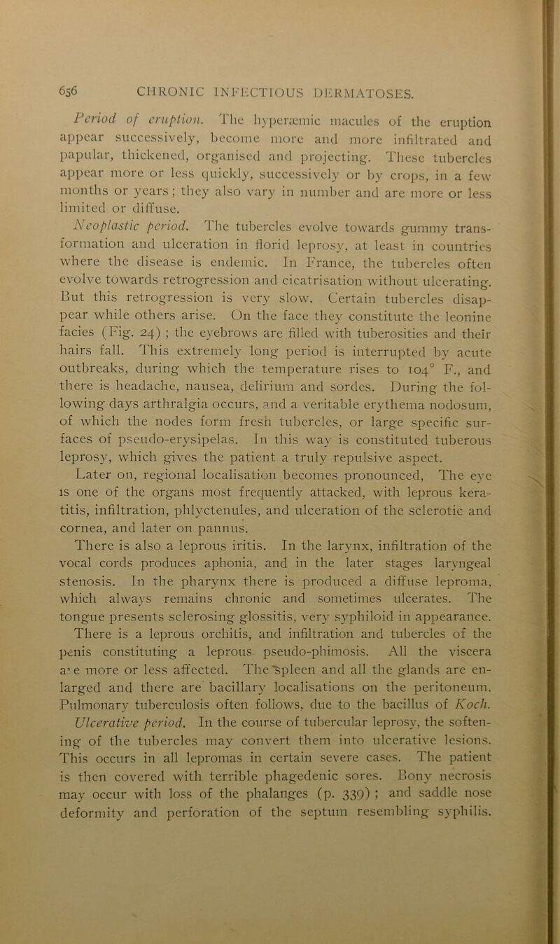 Pcriod of éruption. The hyperæmic macules of the éruption appear successively, become more and more infiltrated and papular, thickened, organised and projccting. These tubercles appear more or less quickly, successively or by crops, in a few months or years; they also vary in number and are more or less limited or diffuse. A eoplastic pcriod. Ihe tubercles evolve towards gummy trans- formation and ulcération in Horid leprosy, at least in countries where the disease is endemic. In France, the tubercles often evolve towards rétrogression and cicatrisation without ulcerating. But this rétrogression is very slow. Certain tubercles disap- pear while others arise. On the face they constitute the leonine faciès (Fig. 24) ; the eyebrows are filled with tuberosities and their hairs fall. This extremely long period is interrupted by acute outbreaks, during which the température rises to 104° F., and there is headache, nausea, delirium and sordes. During the fol- lowing days arthralgia occurs, and a véritable erythema nodosum, of which the nodes form fresh tubercles, or large spécifie sur- faces of pseudo-erysipelas. I11 this way is constituted tuberous leprosy, which gives the patient a truly répulsive aspect. Later on, régional localisation becomes pronounced, The eye is one of the organs most frequently attacked, with leprous kera- titis, infiltration, phlyctenules, and ulcération of the sclerotic and cornea, and later on pannus. There is also a leprous iritis. In the larynx, infiltration of the vocal cords produces aphonia, and in the later stages laryngeal stenosis. In the pharynx there is produced a diffuse leproma, which always remains chronic and sometimes ulcérâtes. The tongue présents sclerosing glossitis, very syphiloid in appearance. There is a leprous orchitis, and infiltration and tubercles of the pénis constituting a leprous pseudo-phimosis. Ail the viscera a1 e more or less afifected. The spleen and ail the glands are en- larged and there are bacillary localisations on the peritoneum. Pulmonary tuberculosis often follows, due to the bacillus of Koch. Ulcerative pcriod. I11 the course of tubercular leprosy, the soften- ing of the tubercles may convert them into ulcerative lésions. This occurs in ail lepromas in certain severe cases. The patient is then covered with terrible phagedenic sores. Bony necrosis may occur with loss of the phalanges (p. 339) ; and saddle nose deformity and perforation of the septum resembling syphilis.