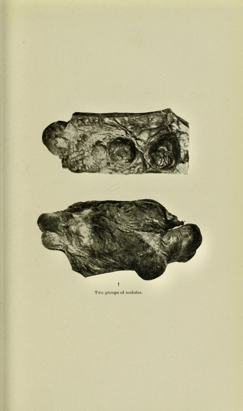 1 Two groups of nodules