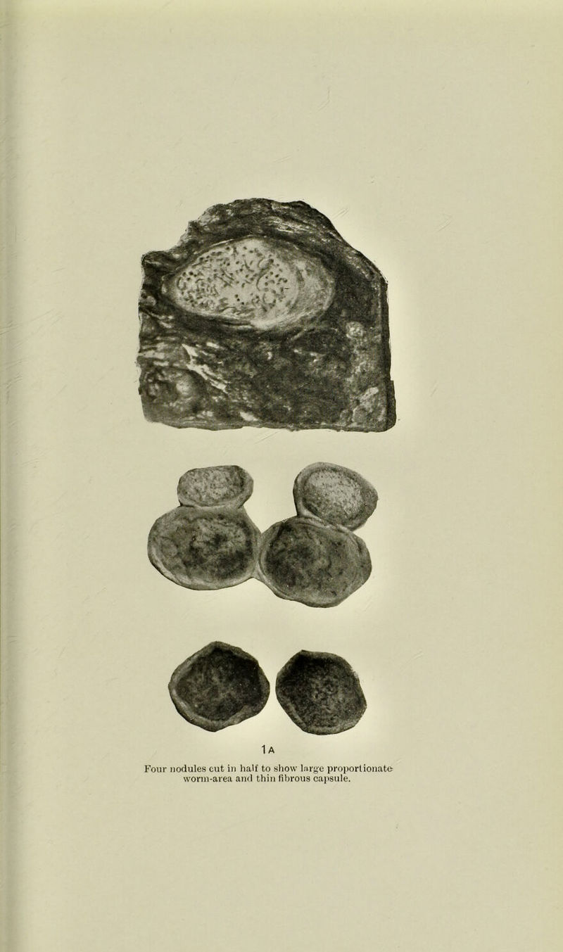 1 A Four nodules cut in half to show large proportionate worm-area and thin fibrous capsule.