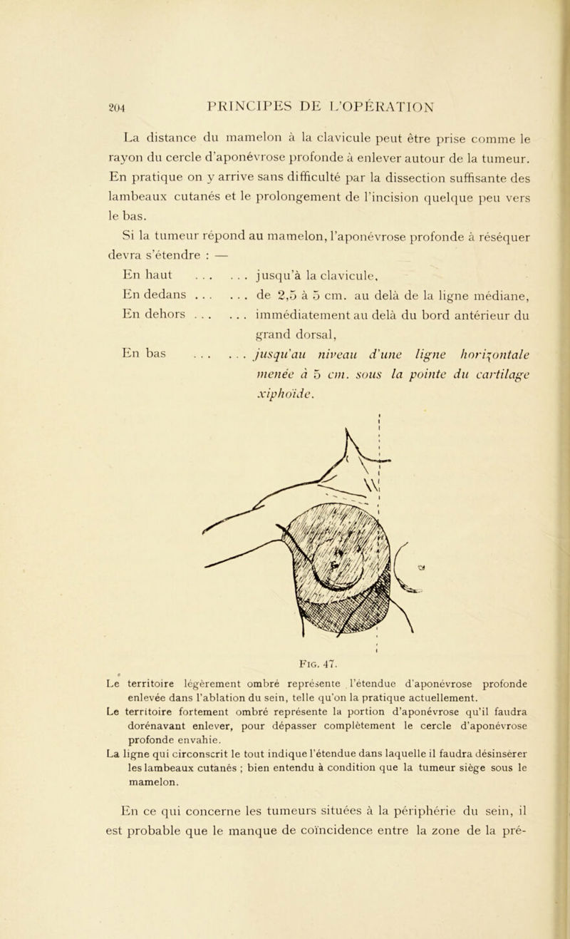 La distance du mamelon à la clavicule peut être prise comme le rayon du cercle d’aponévrose profonde à enlever autour de la tumeur. En pratique on y arrive sans difficulté par la dissection suffisante des lambeaux cutanés et le prolongement de l’incision quelque peu vers le bas. Si la tumeur répond au mamelon, l’aponévrose profonde à réséquer devra s’étendre : — jusqu’à la clavicule, de 2,5 à 5 cm. au delà de la ligne médiane, . . . immédiatement au delà du bord antérieur du grand dorsal, . . . jusqu'au niveau d'une ligne horizontale menée à 5 cm. sous la pointe du cartilage xiphoide. En haut En dedans En dehors En bas i Le territoire légèrement ombré représente l’étendue d’aponévrose profonde enlevée dans l’ablation du sein, telle qu’on la pratique actuellement. Le territoire fortement ombré représente la portion d’aponévrose qu’il faudra dorénavant enlever, pour dépasser complètement le cercle d’aponévrose profonde envahie. La ligne qui circonscrit le tout indique l’étendue dans laquelle il faudra désinserer les lambeaux cutanés ; bien entendu à condition que la tumeur siège sous le mamelon. En ce qui concerne les tumeurs situées à la périphérie du sein, il est probable que le manque de coïncidence entre la zone de la pré-