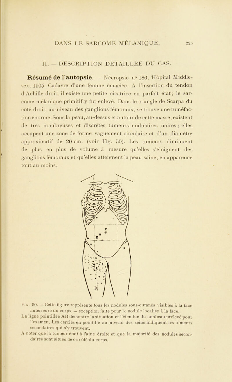 11. — DESCRIPTION DÉTAILLÉE DU CAS. Résumé de l’autopsie. — Nécropsie n<> 18b, Hôpital Middle- sex, 1905. Cadavre d’une femme émaciée. A l’insertion du tendon d’Achille droit, il existe une petite cicatrice en parfait état; le sar- come mélanique primitif y fut enlevé. Dans le triangle de Scarpa du côté droit, au niveau des ganglions fémoraux, se trouve une tuméfac- tion énorme. Sous la peau, au-dessus et autour de cette masse, existent de très nombreuses et discrètes tumeurs nodulaires noires ; elles occupent une zone de forme vaguement circulaire et d’un diamètre approximatif de 20 cm. (voir Fig. 50). Les tumeurs diminuent de plus en plus de volume à mesure qu’elles s’éloignent des ganglions fémoraux et qu’elles atteignent la peau saine, en apparence tout au moins. Fig. 50. —Cette figure représente tous les nodules sous-cutanés visibles à la face antérieure du corps — exception faite pour le nodule localisé à la face. La ligne pointillee AB démontre la situation et l’étendue du lambeau prélevé pour l’examen. Les cercles en pointillé au niveau des seins indiquent les tumeurs secondaires qui s’y trouvent. A noter que la tumeur était à l’aine droite et que la majorité des nodules secon- daires sont situés de ce côté du corps.
