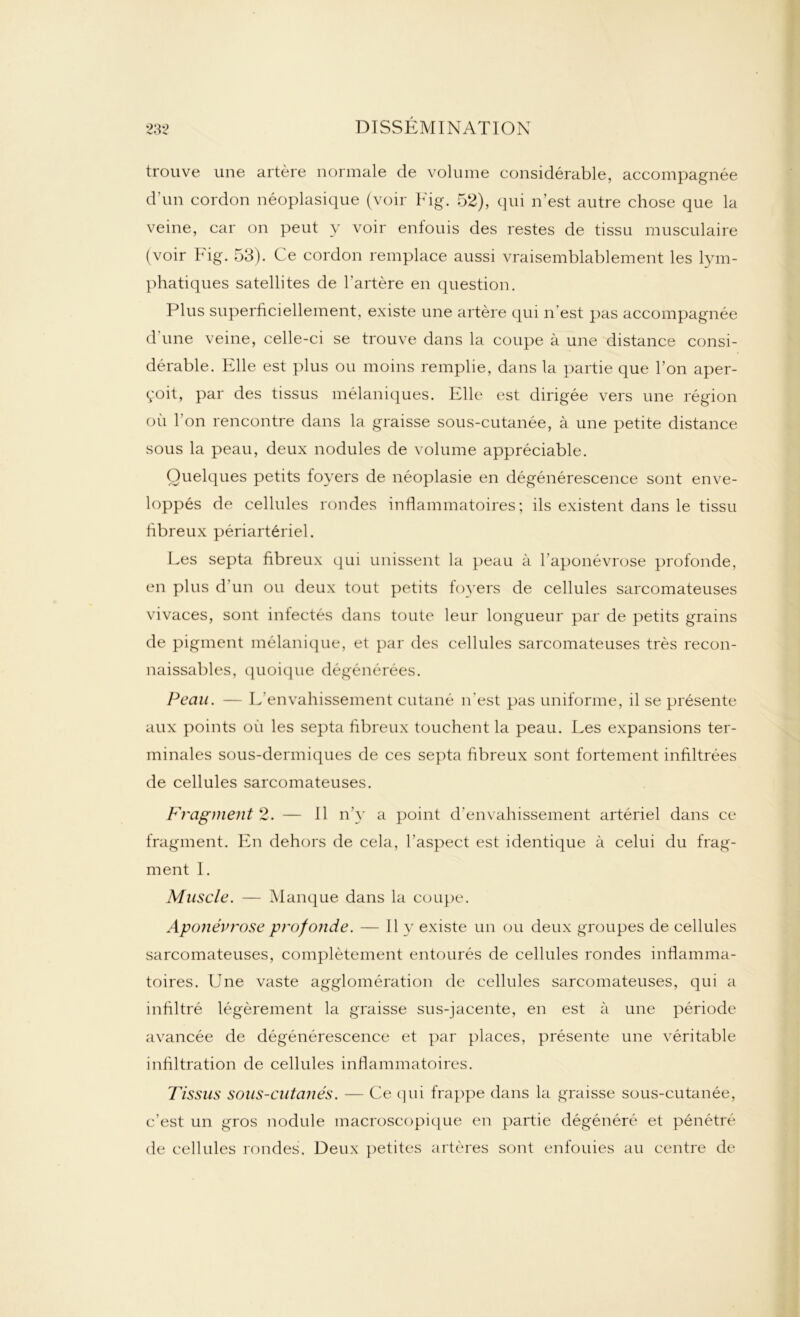 trouve une artère normale de volume considérable, accompagnée d'un cordon néoplasique (voir Fig. 52), qui n’est autre chose que la veine, car on peut y voir enfouis des restes de tissu musculaire (voir Fig. 53). Ce cordon remplace aussi vraisemblablement les lym- phatiques satellites de l’artère en question. Plus superficiellement, existe une artère qui n'est pas accompagnée d'une veine, celle-ci se trouve dans la coupe à une distance consi- dérable. Elle est plus ou moins remplie, dans la partie que l’on aper- çoit, par des tissus mélaniques. Elle est dirigée vers une région où l’on rencontre dans la graisse sous-cutanée, à une petite distance sous la peau, deux nodules de volume appréciable. Quelques petits foyers de néoplasie en dégénérescence sont enve- loppés de cellules rondes inflammatoires; ils existent dans le tissu fibreux périartériel. Les septa fibreux qui unissent la peau à l'aponévrose profonde, en plus d’un ou deux tout petits foyers de cellules sarcomateuses vivaces, sont infectés dans toute leur longueur par de petits grains de pigment mélanique, et par des cellules sarcomateuses très recon- naissables, quoique dégénérées. Peau. — L’envahissement cutané n’est pas uniforme, il se présente aux points où les septa fibreux touchent la peau. Les expansions ter- minales sous-dermiques de ces septa fibreux sont fortement infiltrées de cellules sarcomateuses. Fragment 2. — Il n’y a point d'envahissement artériel dans ce fragment. En dehors de cela, l’aspect est identique à celui du frag- ment I. Muscle. — Manque dans la coupe. Aponévrose profonde. — Il y existe un ou deux groupes de cellules sarcomateuses, complètement entourés de cellules rondes inflamma- toires. Une vaste agglomération de cellules sarcomateuses, qui a infiltré légèrement la graisse sus-jacente, en est à une période avancée de dégénérescence et par places, présente une véritable infiltration de cellules inflammatoires. Tissus sous-cutanés. — Ce qui frappe dans la graisse sous-cutanée, c’est un gros nodule macroscopique en partie dégénéré et pénétré de cellules rondes. Deux petites artères sont enfouies au centre de