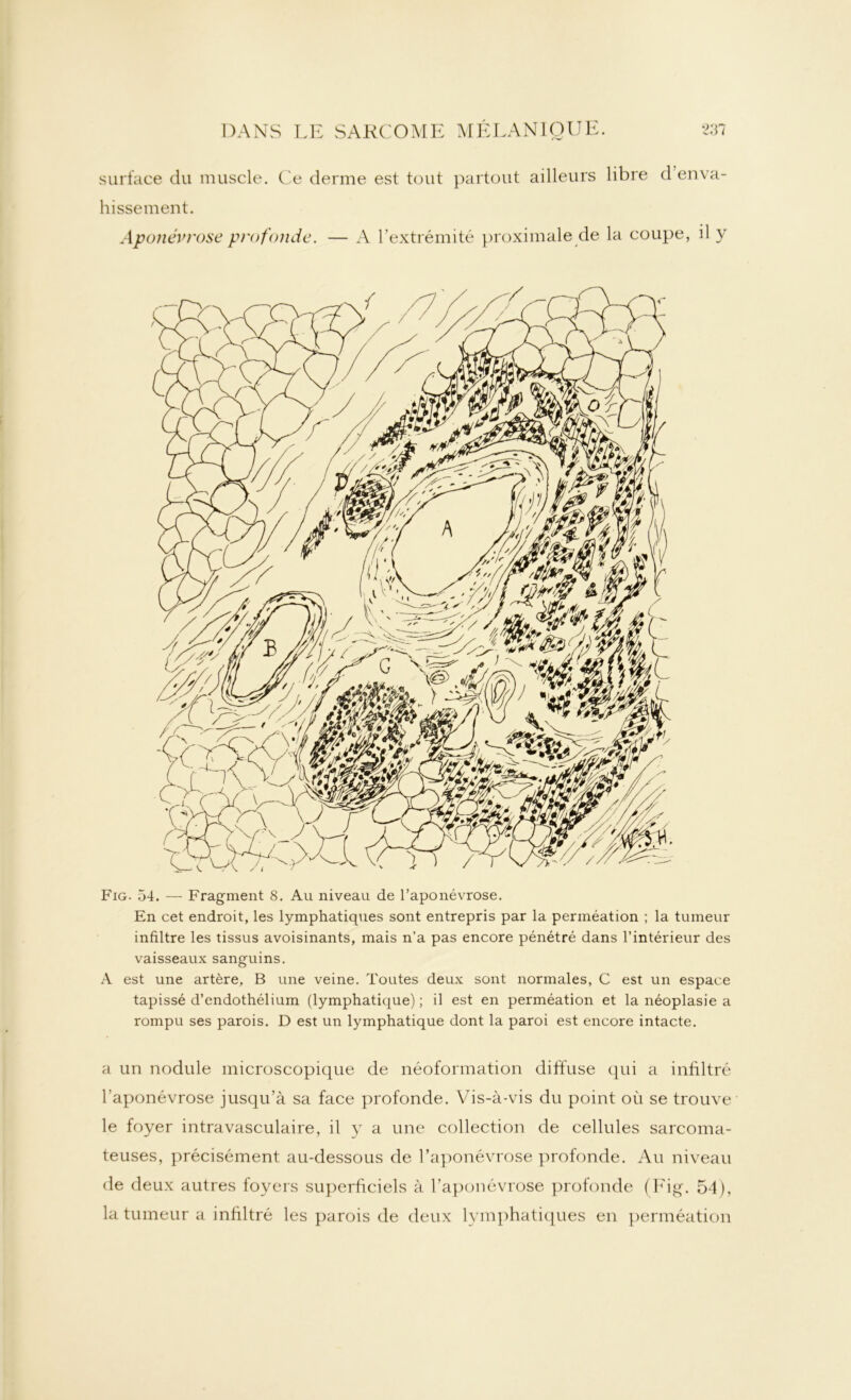 surface du muscle. Ce derme est tout partout ailleurs libre dériva- hissement. Aponévrose profonde. — A l’extrémité proximale de la coupe, il y Fig. 54. — Fragment 8. Au niveau de l’aponévrose. En cet endroit, les lymphatiques sont entrepris par la perméation ; la tumeur infiltre les tissus avoisinants, mais n’a pas encore pénétré dans l’intérieur des vaisseaux sanguins. A est une artère, B une veine. Toutes deux sont normales, C est un espace tapissé d’endothélium (lymphatique); il est en perméation et la néoplasie a rompu ses parois. D est un lymphatique dont la paroi est encore intacte. a un nodule microscopique de néoformation diffuse qui a infiltré l’aponévrose jusqu’à sa face profonde. Vis-à-vis du point où se trouve le foyer intravasculaire, il y a une collection de cellules sarcoma- teuses, précisément au-dessous de l’aponévrose profonde. Au niveau de deux autres loyers superficiels à l’aponévrose profonde (Fig. 54), la tumeur a infiltré les parois de deux lymphatiques en perméation