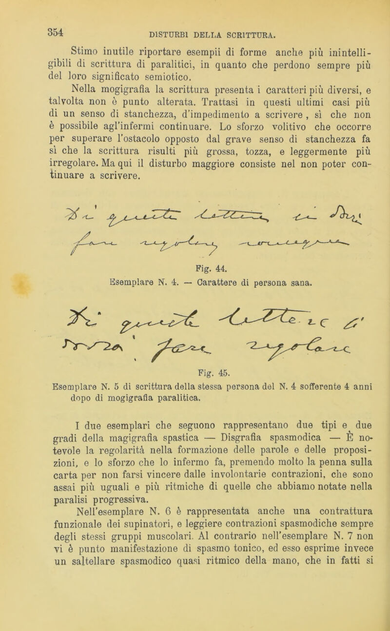 Stimo inutile riportare esempii di forme anche più inintelli- gibili di scrittura di paralitici, in quanto che perdono sempre più del loro significato semiotico. Nella mogigrafia la scrittura presenta i caratteri più diversi, e talvolta non è punto alterata. Trattasi in questi ultimi casi più di un senso di stanchezza, d’impedimento a scrivere , sì che non è possibile agl’infermi continuare. Lo sforzo volitivo che occorre per superare l’ostacolo opposto dal grave senso di stanchezza fa sì che la scrittura risulti più grossa, tozza, e leggermente più irregolare. Ma qui il disturbo maggiore consiste nel non poter con- tinuare a scrivere. Fig. 45. Esemplare N. 5 di scrittura della stessa persona del N. 4 sofferente 4 anni dopo di mogigrafia paralitica. I due esemplari che seguono rappresentano due tipi e due gradi della magigrafìa spastica — Disgrafia spasmodica — È no- tevole la regolarità nella formazione delle parole e delle proposi- zioni, e lo sforzo che lo infermo fa, premendo molto la penna sulla carta per non farsi vincere dalle involontarie contrazioni, che sono assai più uguali e più ritmiche di quelle che abbiamo notate nella paralisi progressiva. Nell’esemplare N. 6 è rappresentata anche una contrattura funzionale dei supinatori, e leggiere contrazioni spasmodiche sempre degli stessi gruppi muscolari. Al contrario nell'esemplare N. 7 non vi è punto manifestazione di spasmo tonico, ed esso esprime invece un saltellare spasmodico quasi ritmico della mano, che in fatti si  y Fig. 44. Esemplare N. 4. — Carattere di persona sana.