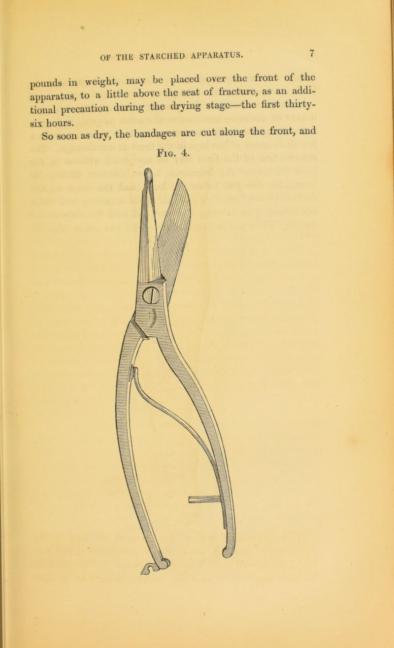 pounds in weight, may be placed over the front of the apparatus, to a little above the seat of fracture, as an addi- tional precaution during the diying stage the first thirty- six hours. So soon as dry, the bandages are cut along the front, and