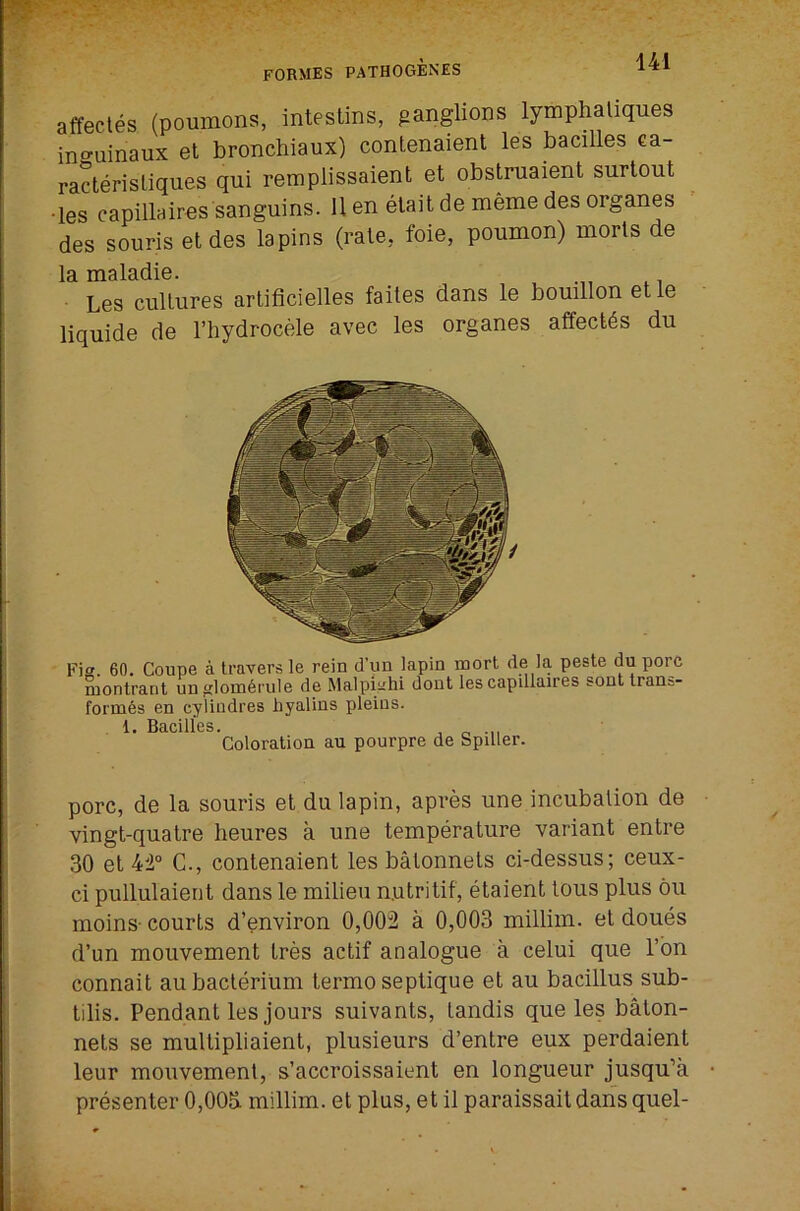 affectes (poumons, inteslms, ganglions lymphaliques ino-uinaux et bronchiaux) contenaient les bacilles ca- racterisliques qui remplissaient et obstruaient surtout •les capillaires sanguins. 11 en elait de meme des organes des souris et des lapins (rate, foie, poumon) morls de la maladie. Les cultures artificielles faites dans le bouillon etle liquide de I’liydrocele avec les organes affectes du F)<' 60. Coupe a travers le rein d'un lapin mort de la peste du pore montrant un j;lom6mle de Malpkhi dont les capdlaires sont trans- formes en cyliudres hyalins pleius. 1. Bacilles. , r, -n Coloration au pourpre de Spiller. pore, de la souris et du lapin, apres une incubation de vingt-quatre heures a une temperature variant entre 30 et C., contenaient les batonnets ci-dessus; ceux- ci pullulaient dans le milieu n.utritif, etaient tous plus 6u moins- courts d’environ 0,002 a 0,003 millim. et doues d’un mouvement tres actif analogue a celui que I’bn connait au bacterium termo septique et au bacillus sub- tilis. Pendant les jours suivants, tandis que les baton- nets se multipliaient, plusieurs d’entre eux perdaient leur mouvement, s’accroissaient en longueur jusqu’a presenter 0,003 millim. et plus, et il paraissait dans quel-