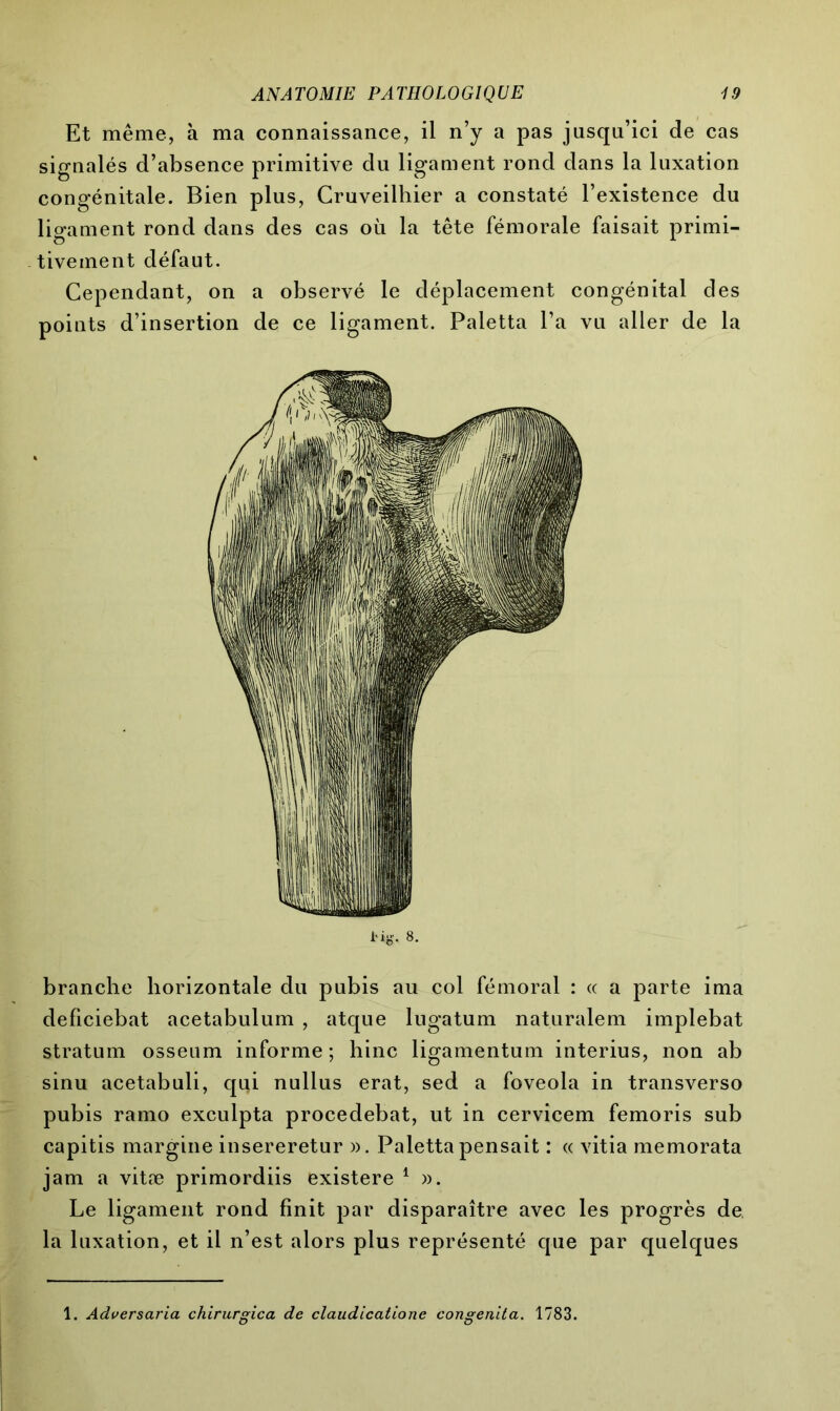 Et même, à ma connaissance, il n’y a pas jusqu’ici de cas signalés d’absence primitive du ligament rond dans la luxation congénitale. Bien plus, Cruveilhier a constaté l’existence du ligament rond dans des cas où la tête fémorale faisait primi- tivement défaut. Cependant, on a observé le déplacement congénital des points d’insertion de ce ligament. Paletta l’a vu aller de la Hg. 8. branche horizontale du pubis au col fémoral : « a parte ima deficiebat acetabulum , atque lugatum naturalem implebat stratum osseum informe ; hinc ligamentum interius, non ab sinu acetabuli, qui nullus erat, sed a foveola in transverso pubis ramo exculpta procedebat, ut in cervicem femoris sub capitis margine insereretur ». Paletta pensait : « vitia memorata jam a vitæ primordiis existere 1 », Le ligament rond finit par disparaître avec les progrès de. la luxation, et il n’est alors plus représenté que par quelques 1. Adversaria chirurgica de claudicatione congenita. 1783.