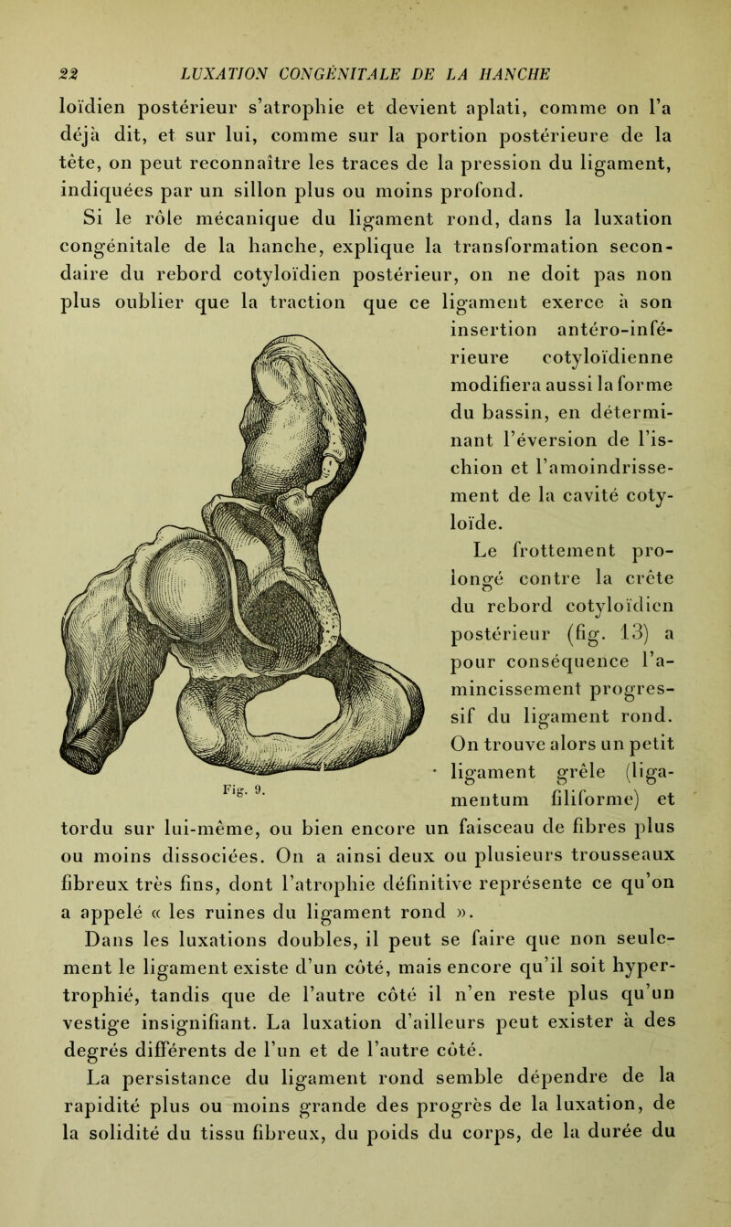 loïdien postérieur s’atrophie et devient aplati, comme on l’a déjà dit, et sur lui, comme sur la portion postérieure de la tête, on peut reconnaître les traces de la pression du ligament, indiquées par un sillon plus ou moins profond. Si le rôle mécanique du ligament rond, dans la luxation congénitale de la hanche, explique la transformation secon- daire du rebord cotyloïdien postérieur, on ne doit pas non plus oublier que la traction que ce ligament exerce à son insertion antéro-infé- rieure cotyloïdienne modifiera aussi la forme du bassin, en détermi- nant l’éversion de l’is- chion et l’amoindrisse- ment de la cavité coty- loïde. Le frottement pro- longé contre la crête du rebord cotyloïdien postérieur (fig. 13) a pour conséquence l’a- mincissement progres- sif du ligament rond. On trouve alors un petit ligament grêle (ii ga- me n t u m filiforme) et tordu sur lui-même, ou bien encore un faisceau de fibres plus ou moins dissociées. On a ainsi deux ou plusieurs trousseaux Fig. 9. fibreux très fins, dont l’atrophie définitive représente ce qu’on a appelé « les ruines du ligament rond ». Dans les luxations doubles, il peut se faire que non seule- ment le ligament existe d’un côté, mais encore qu’il soit hyper- trophié, tandis que de l’autre côté il n’en reste plus qu’un vestige insignifiant. La luxation d’ailleurs peut exister à des degrés différents de l’un et de l’autre côté. La persistance du ligament rond semble dépendre de la rapidité plus ou moins grande des progrès de la luxation, de la solidité du tissu fibreux, du poids du corps, de la durée du