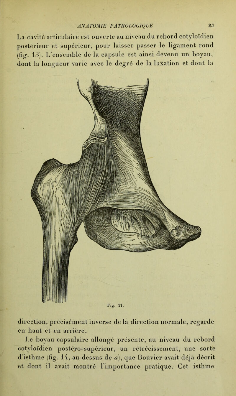 La cavité articulaire est ouverte au niveau du rebord cotyloïdien postérieur et supérieur, pour laisser passer le ligament rond (fig. 13). L’ensemble de la capsule est ainsi devenu un boyau, dont la longueur varie avec le degré de la luxation et dont la Fig. H. direction, précisément inverse de la direction normale, regarde en haut et en arrière. Le boyau capsulaire allongé présente, au niveau du rebord cotyloïdien postéro-supérieur, un rétrécissement, une sorte d’isthme (fig. 14, au-dessus de a), que Bouvier avait déjà décrit et dont il avait montré l’importance pratique. Cet isthme