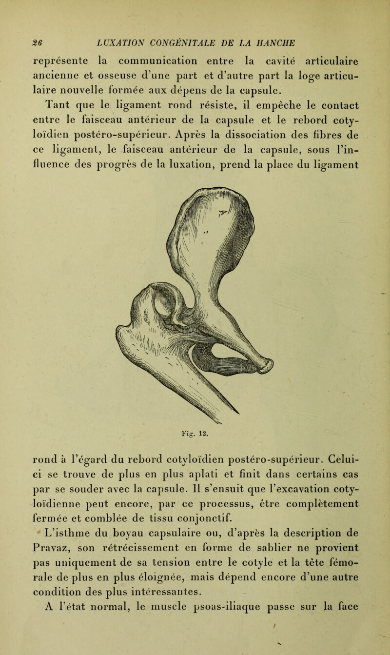 représente la communication entre la cavité articulaire ancienne et osseuse d’une part et d’autre part la loge articu- laire nouvelle formée aux dépens de la capsule. Tant que le ligament rond résiste, il empêche le contact entre le faisceau antérieur de la capsule et le rebord coty- loïdien postéro-supérieur. Après la dissociation des fibres de ce ligament, le faisceau antérieur de la capsule, sous l’in- fluence des progrès de la luxation, prend la place du ligament Fig. 12. rond à l’égard du rebord cotyloïdien postéro-supérieur. Celui- ci se trouve de plus en plus aplati et finit dans certains cas par se souder avec la capsule. Il s’ensuit que l’excavation coty- loïdienne peut encore, par ce processus, être complètement fermée et comblée de tissu conjonctif. L’isthme du boyau capsulaire ou, d’après la description de Pravaz, son rétrécissement en forme de sablier ne provient pas uniquement de sa tension entre le cotyle et la tête fémo- rale de plus en plus éloignée, mais dépend encore d’une autre condition des plus intéressantes. A l’état normal, le muscle psoas-iliaque passe sur la face