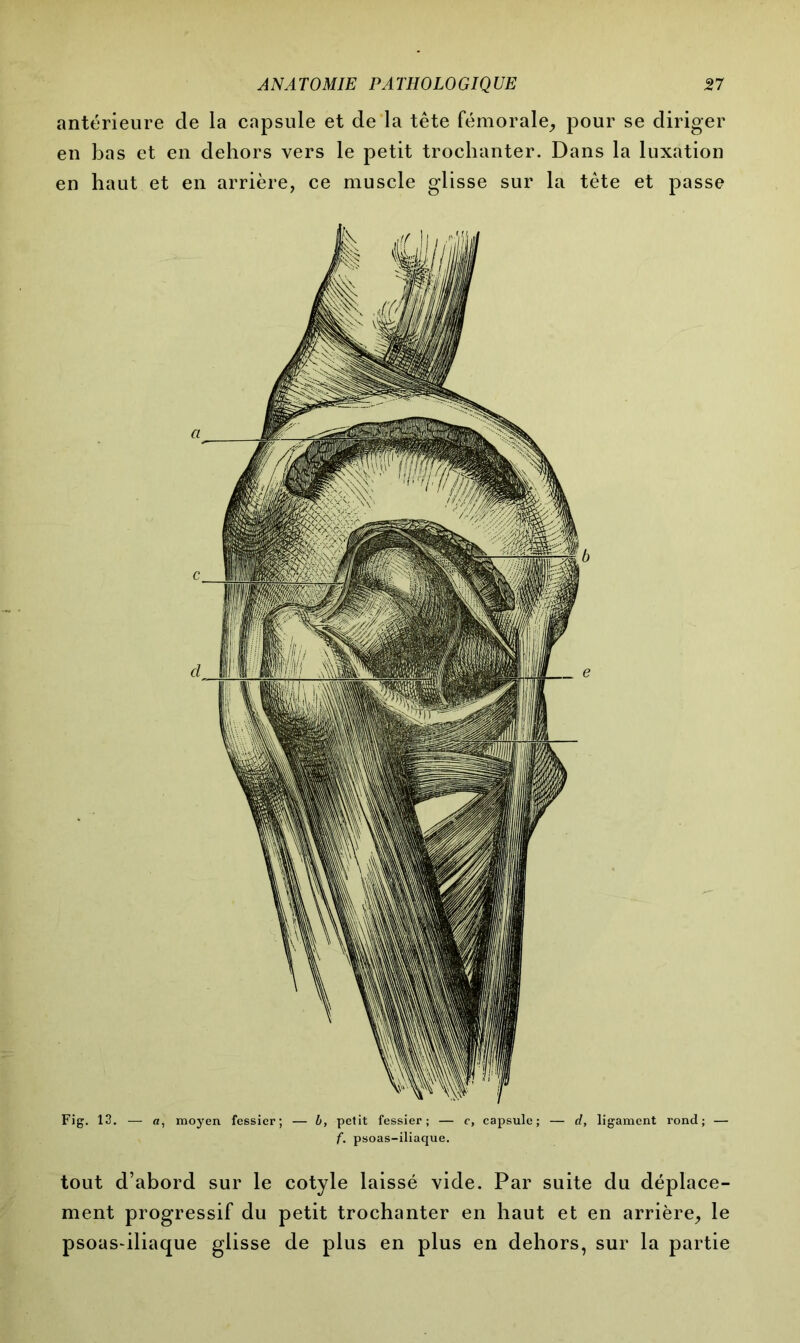 antérieure de la capsule et de la tête fémorale, pour se diriger en bas et en dehors vers le petit trochanter. Dans la luxation en haut et en arrière, ce muscle glisse sur la tête et passe Fig. 13. — a, moyen fessier; — b, petit fessier; — c, capsule; — d, ligament rond; — f. psoas-iliaque. tout d’abord sur le cotyle laissé vide. Par suite du déplace- ment progressif du petit trochanter en haut et en arrière, le psoas-iliaque glisse de plus en plus en dehors, sur la partie