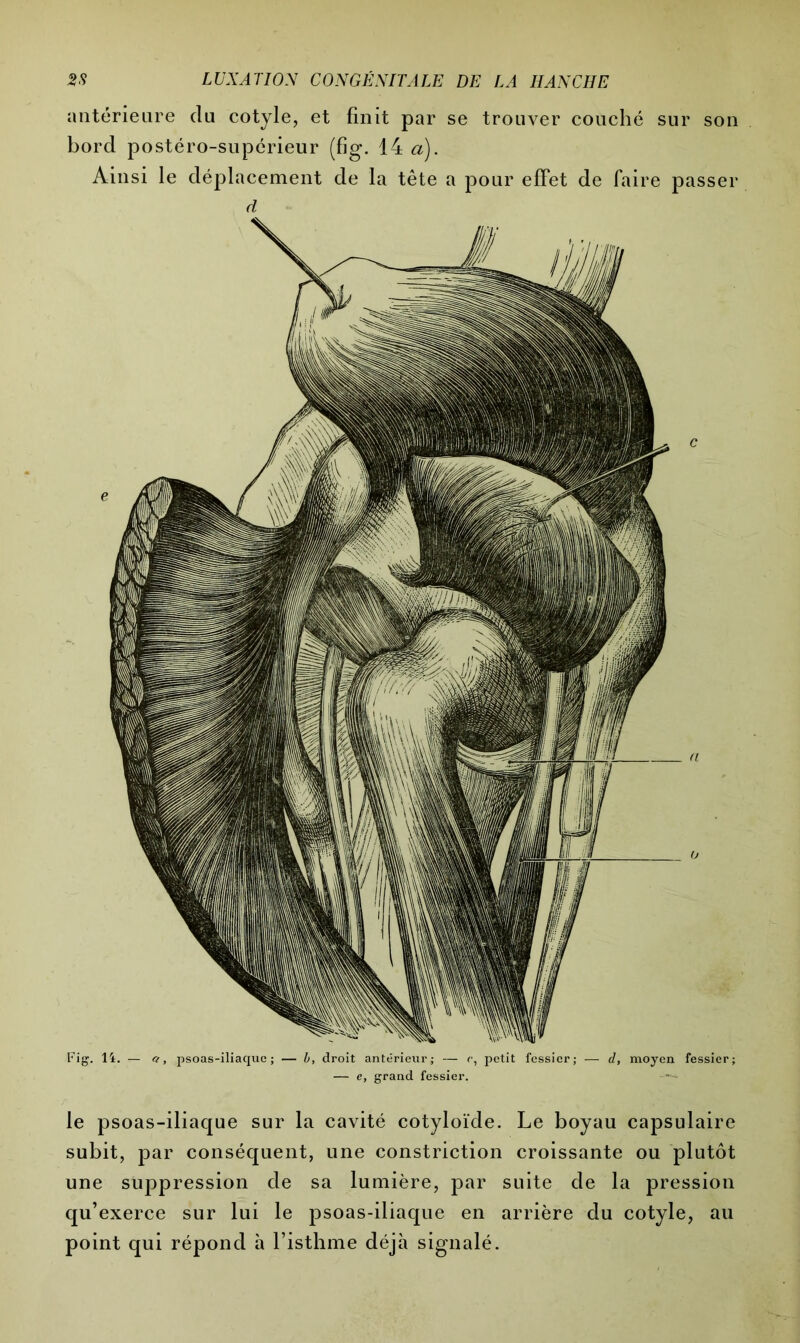 antérieure du cotyle, et finit par se trouver couché sur son bord postéro-supérieur (fig. 14 a). Ainsi le déplacement de la tête a pour effet de faire passer d Fig. li. — et, psoas-iliaque; — b, droit antérieur; — e, petit fessier; — d, moyen fessier; — e, grand fessier. -- le psoas-iliaque sur la cavité cotyloïde. Le boyau capsulaire subit, par conséquent, une constriction croissante ou plutôt une suppression de sa lumière, par suite de la pression qu’exerce sur lui le psoas-iliaque en arrière du cotyle, au point qui répond à l’isthme déjà signalé.