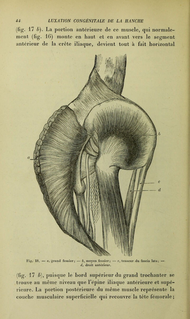 (fig. 17 b). La portion antérieure de ce muscle, qui normale- ment (fig. 16) monte en haut et en avant vers le segment antérieur de la crête iliaque, devient tout à fait horizontal Fig. 18. — a, grand fessier; — 6, moyen fessier; — c, tenseur du fascia lata; — d, droit antérieur. (fig. 17 b), puisque le bord supérieur du grand trochanter se trouve au même niveau que l’épine iliaque antérieure et supé- rieure. La portion postérieure du même muscle représente la couche musculaire superficielle qui recouvre la tête fémorale;