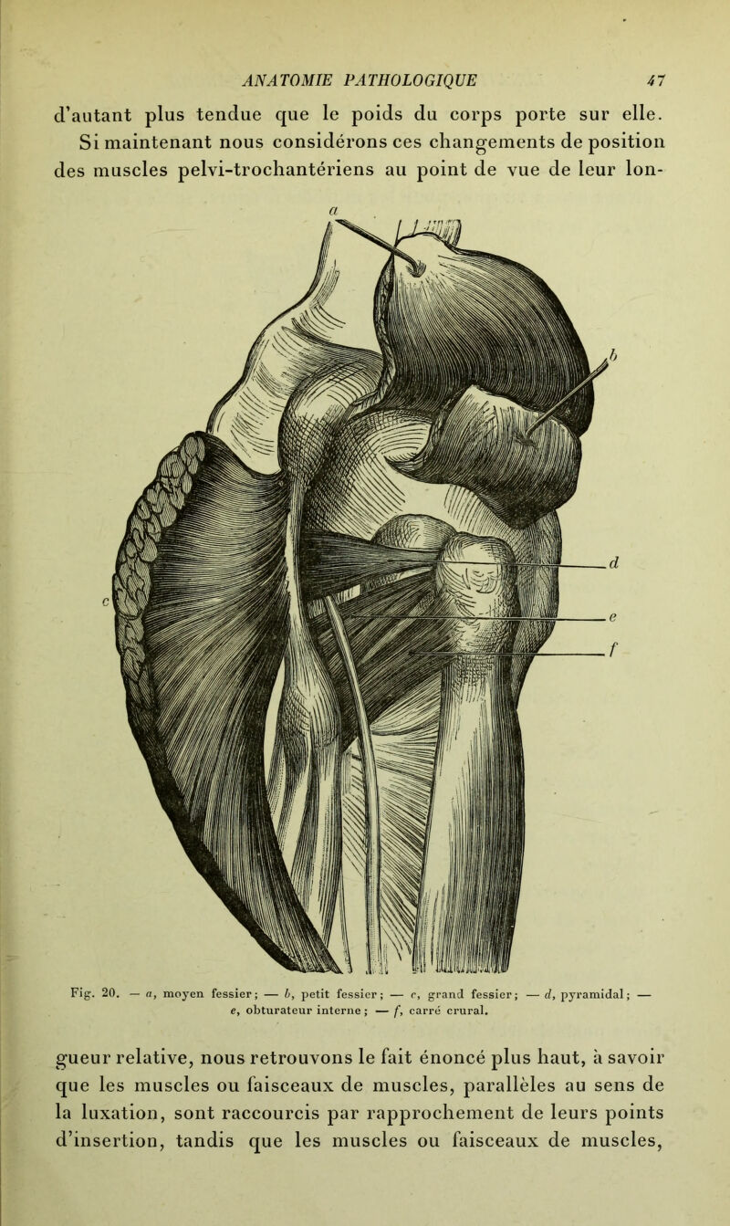 d’autant plus tendue que le poids du corps porte sur elle. Si maintenant nous considérons ces changements de position des muscles pelvi-trochantériens au point de vue de leur lon- a Fig. 20. — a, moyen fessier; — b, petit fessier; — c, grand fessier; — d, pyramidal; — e, obturateur interne ; — f, carré crural. gueur relative, nous retrouvons le fait énoncé plus haut, à savoir que les muscles ou faisceaux de muscles, parallèles au sens de la luxation, sont raccourcis par rapprochement de leurs points d’insertion, tandis que les muscles ou faisceaux de muscles,