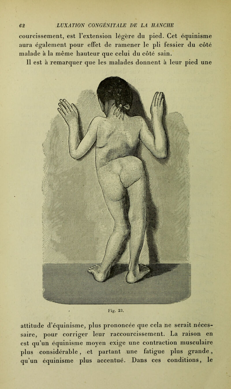 courcissement, est l’extension légère du pied. Cet équinisme aura également pour effet de ramener le pli fessier du côté malade à la même hauteur que celui du côté sain. Il est à remarquer que les malades donnent à leur pied une Fig. 23. attitude d’équinisme, plus prononcée que cela ne serait néces- saire, pour corriger leur raccourcissement. La raison en est qu’un équinisme moyen exige une contraction musculaire plus considérable, et partant une fatigue plus grande , qu’un équinisme plus accentué. Dans ces conditions, le